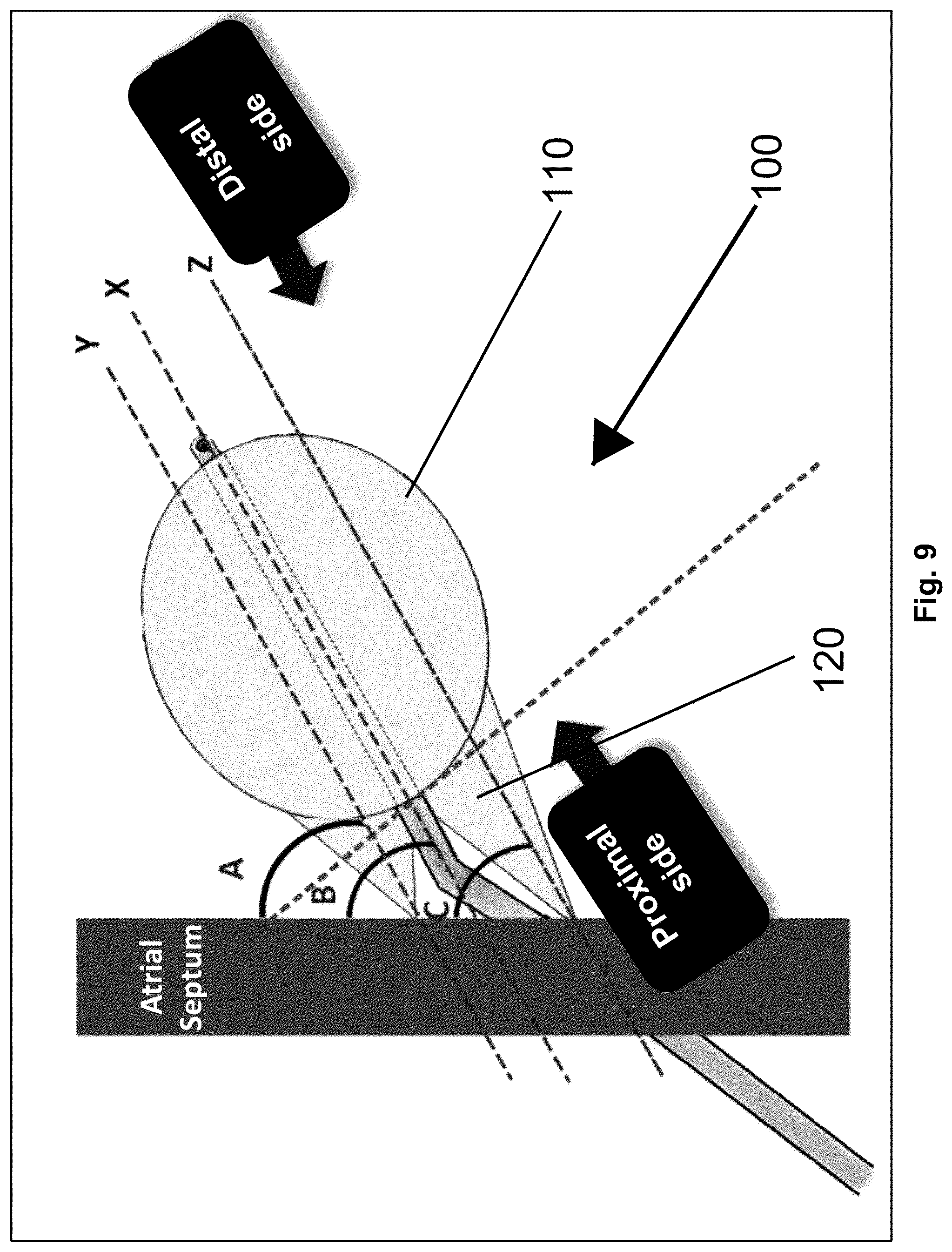 Patent US12310616 Figure 9 – Septostomy balloon catheter
