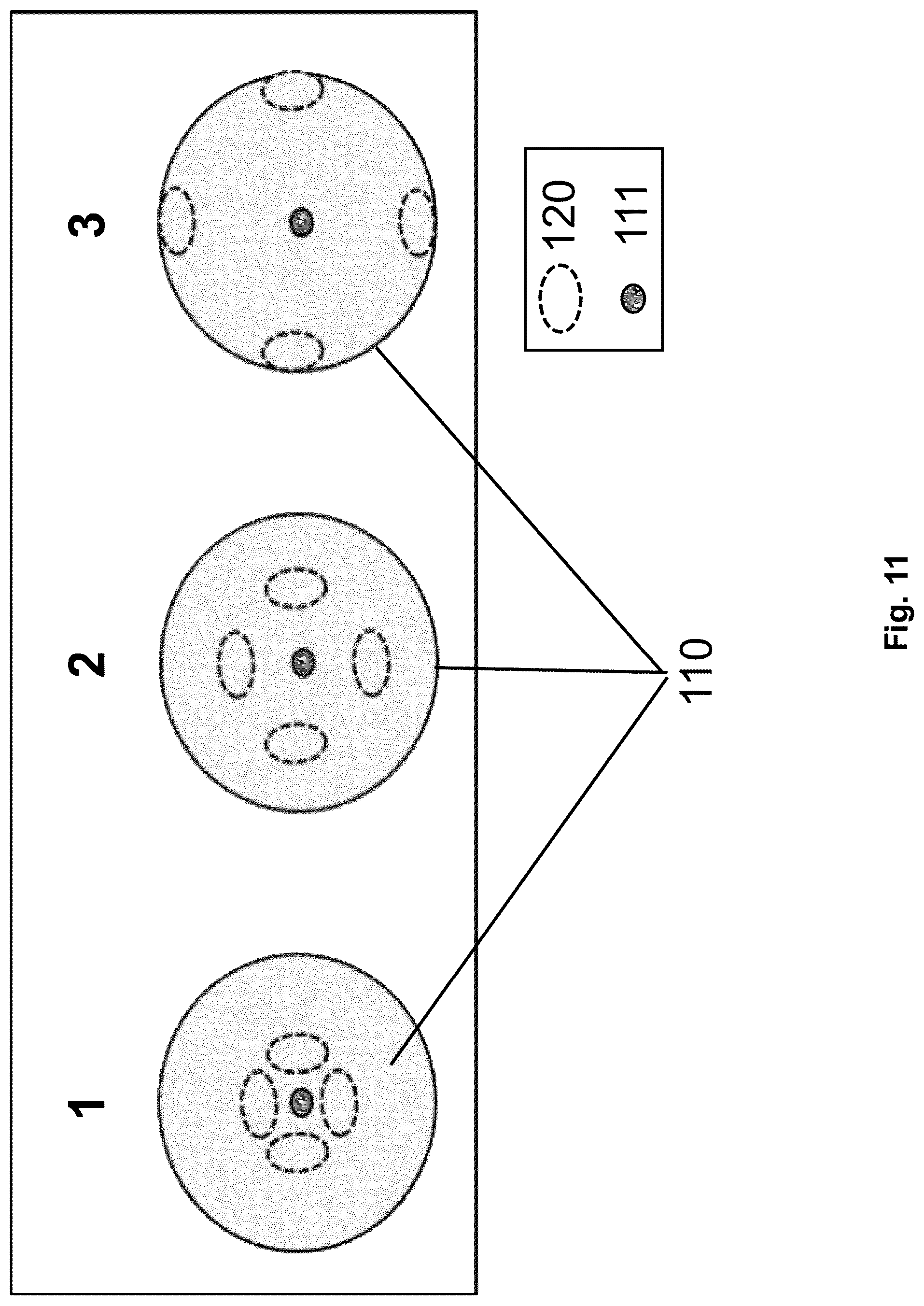 Patent US12310616 Figure 11 – Septostomy balloon catheter