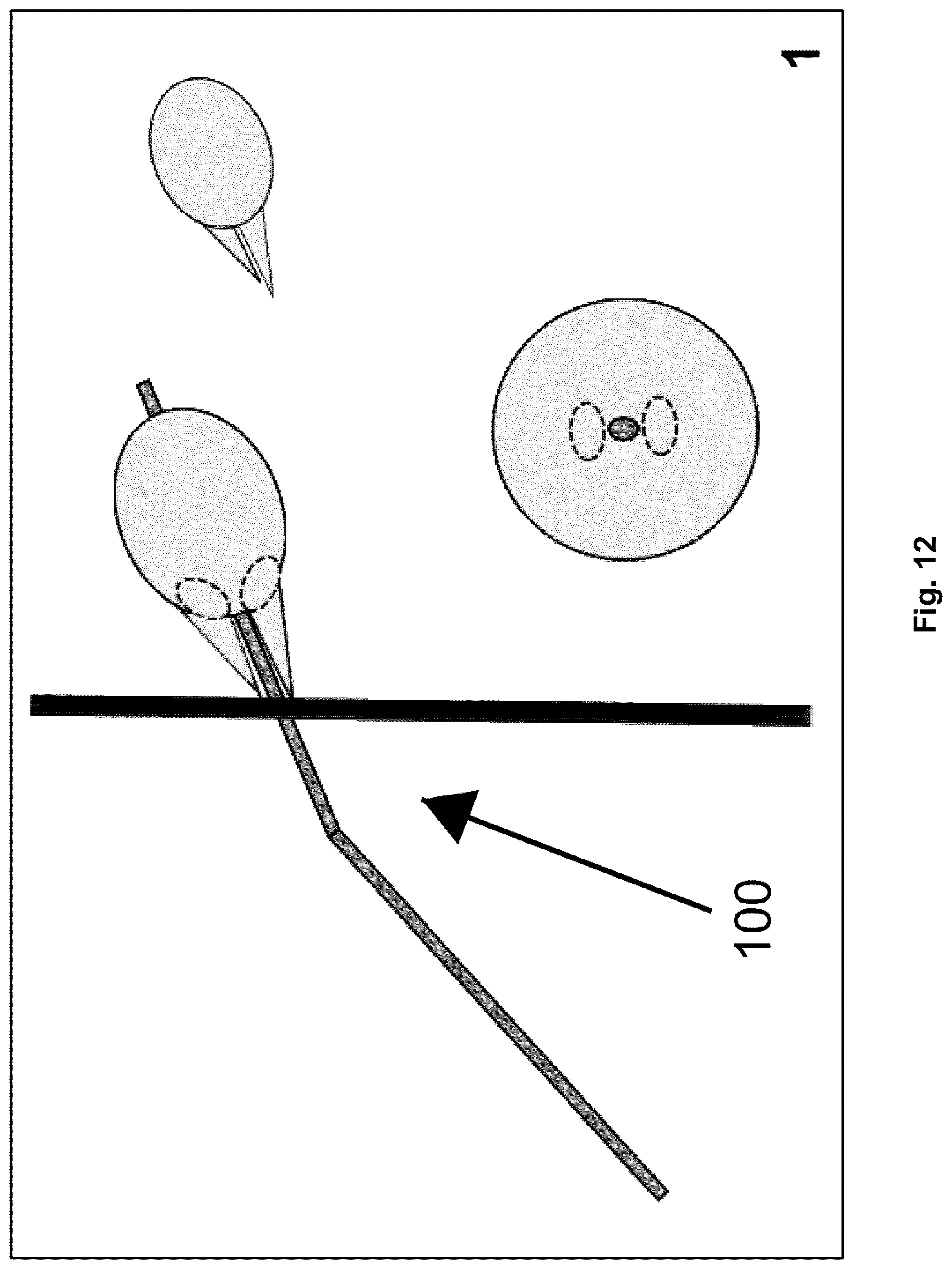 Patent US12310616 Figure 12 – Septostomy balloon catheter