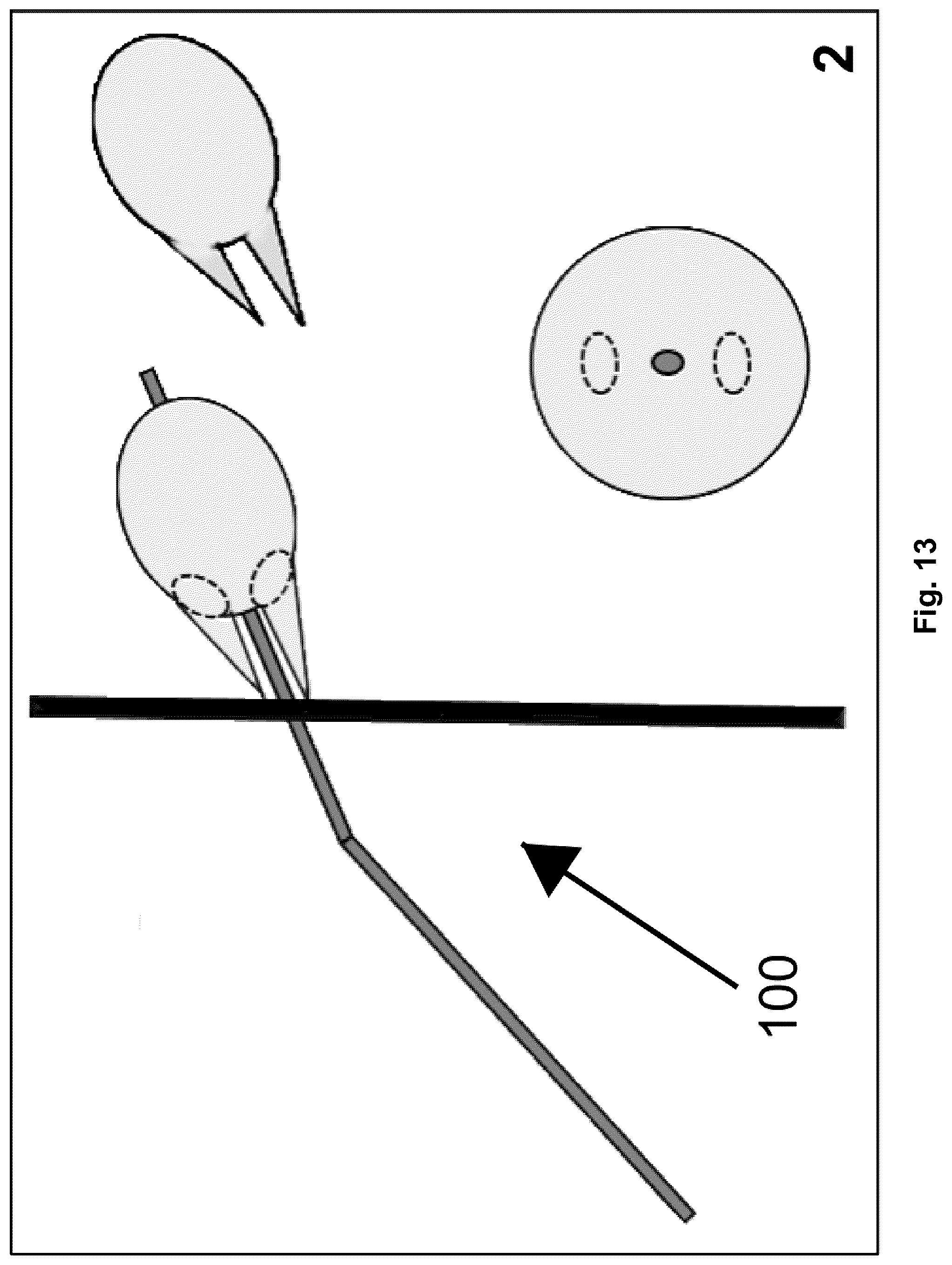 Patent US12310616 Figure 13 – Septostomy balloon catheter