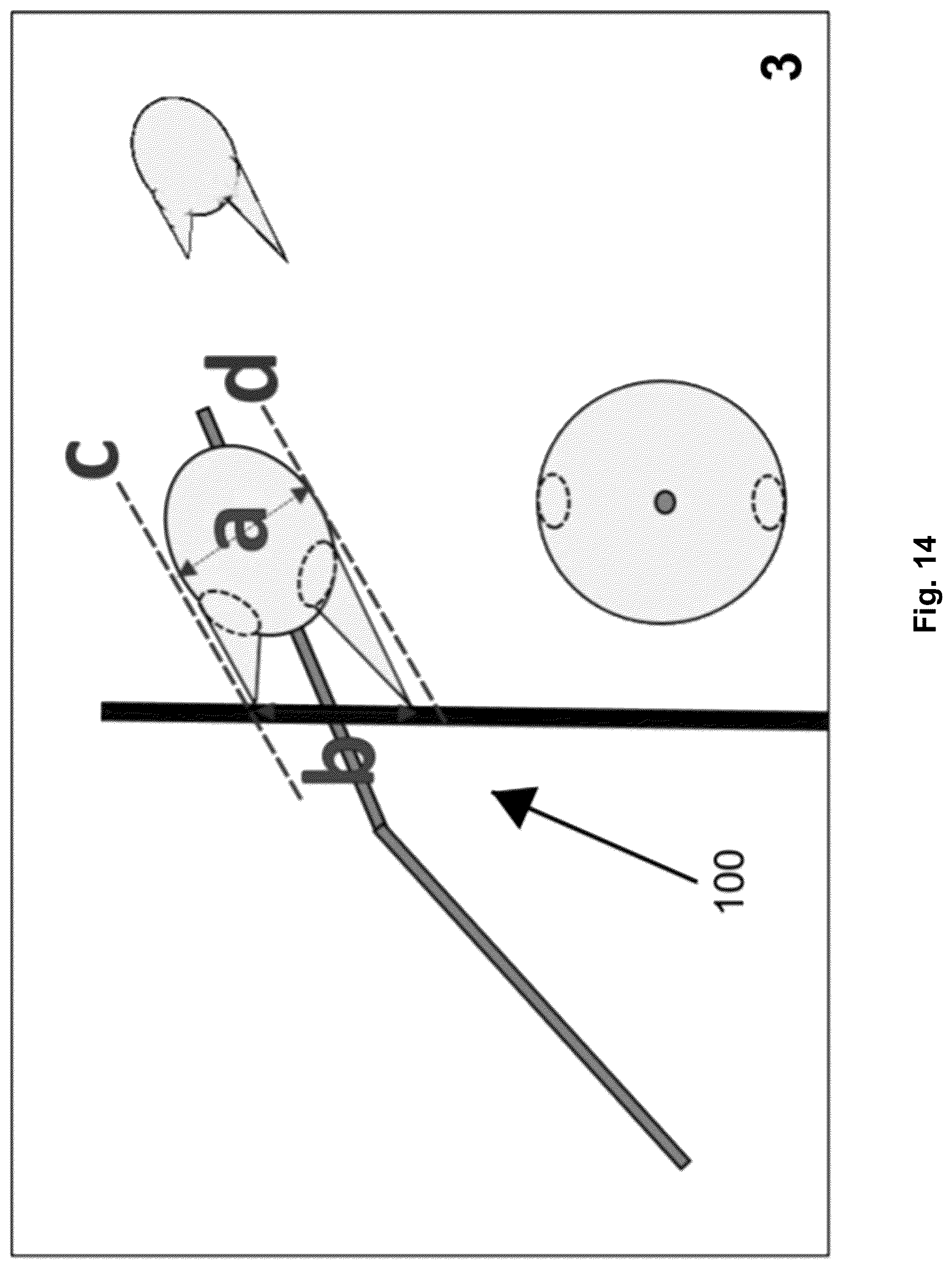 Patent US12310616 Figure 14 – Septostomy balloon catheter