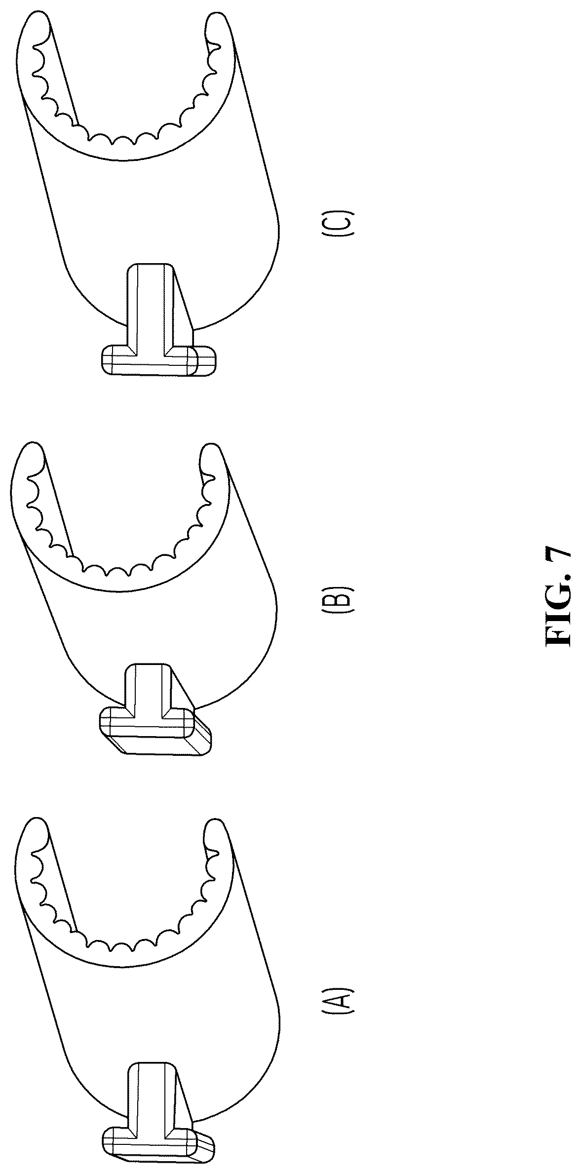 Patent US12310618 Figure 7 – Ultrasound probe detachable injection assistant