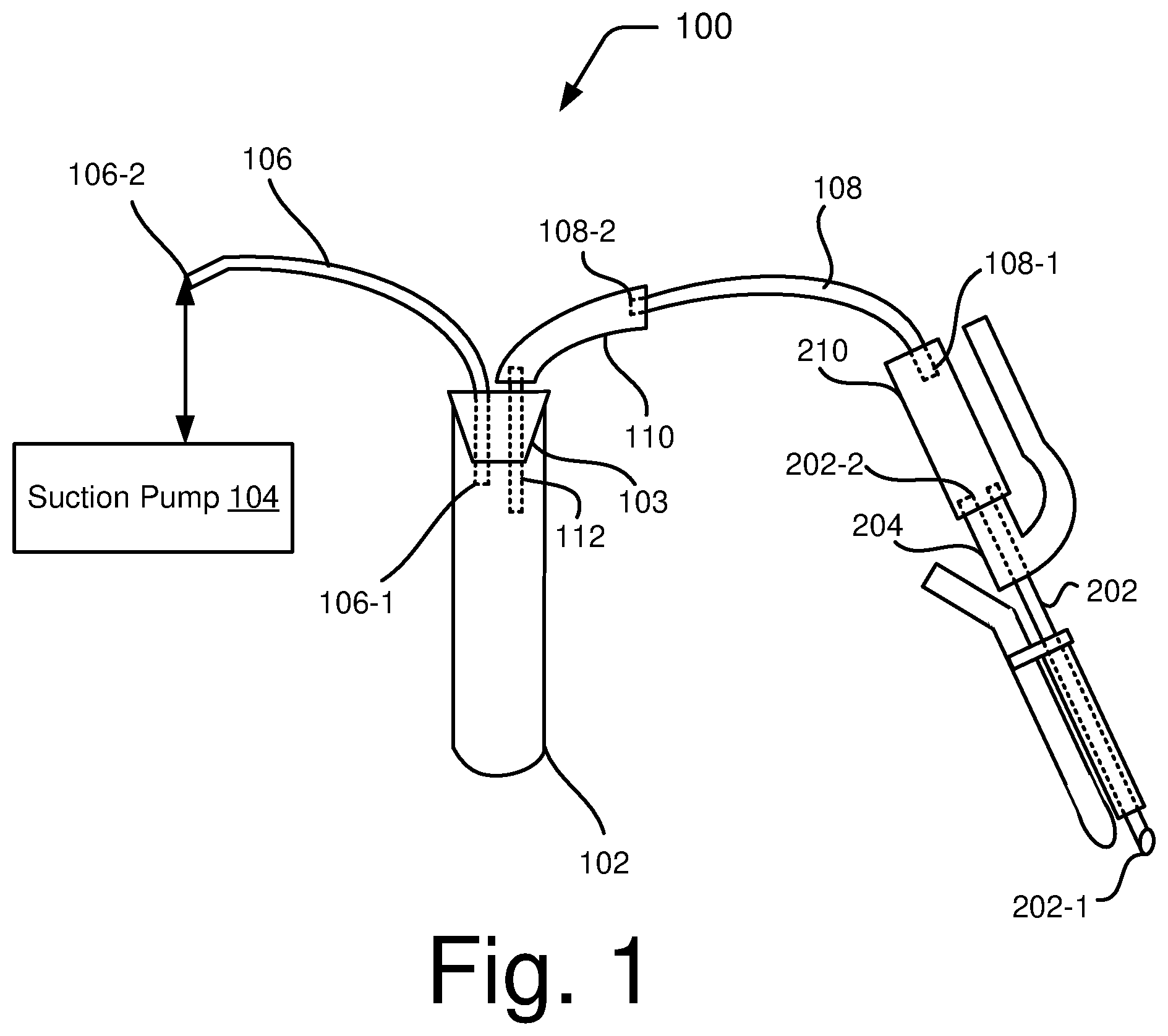 Patent US12310624 Figure 1 – Follicular fluid aspiration