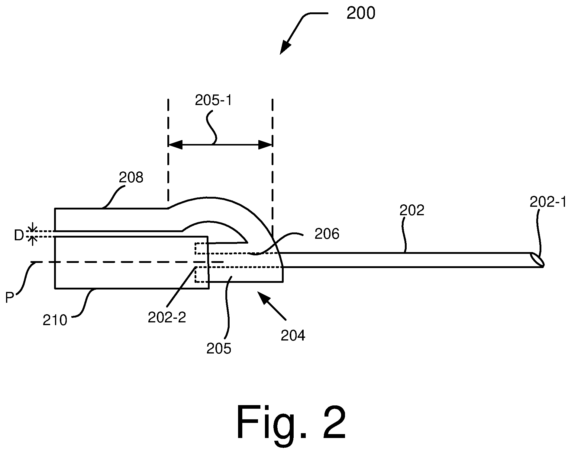 Patent US12310624 Figure 2 – Follicular fluid aspiration