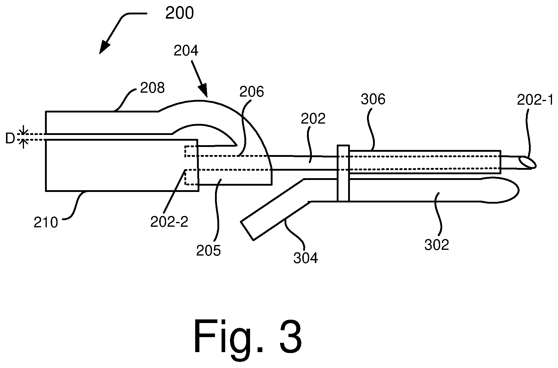 Patent US12310624 Figure 3 – Follicular fluid aspiration