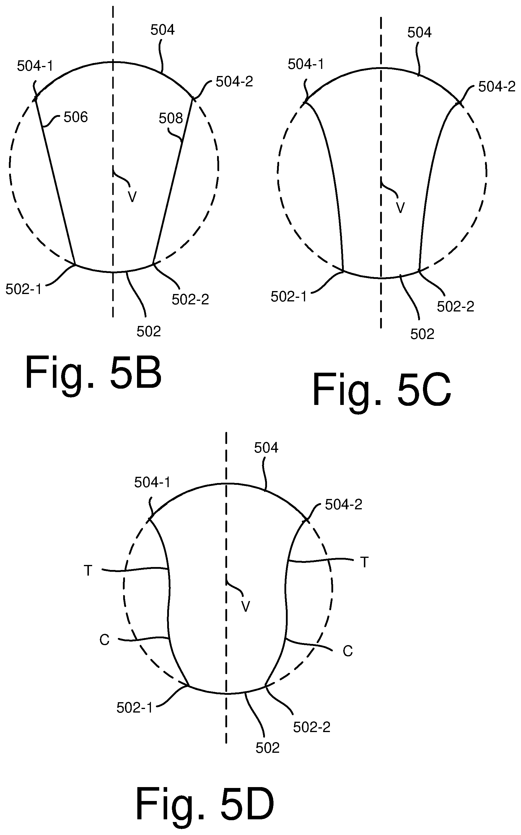 Patent US12310624 Figure 6 – Follicular fluid aspiration