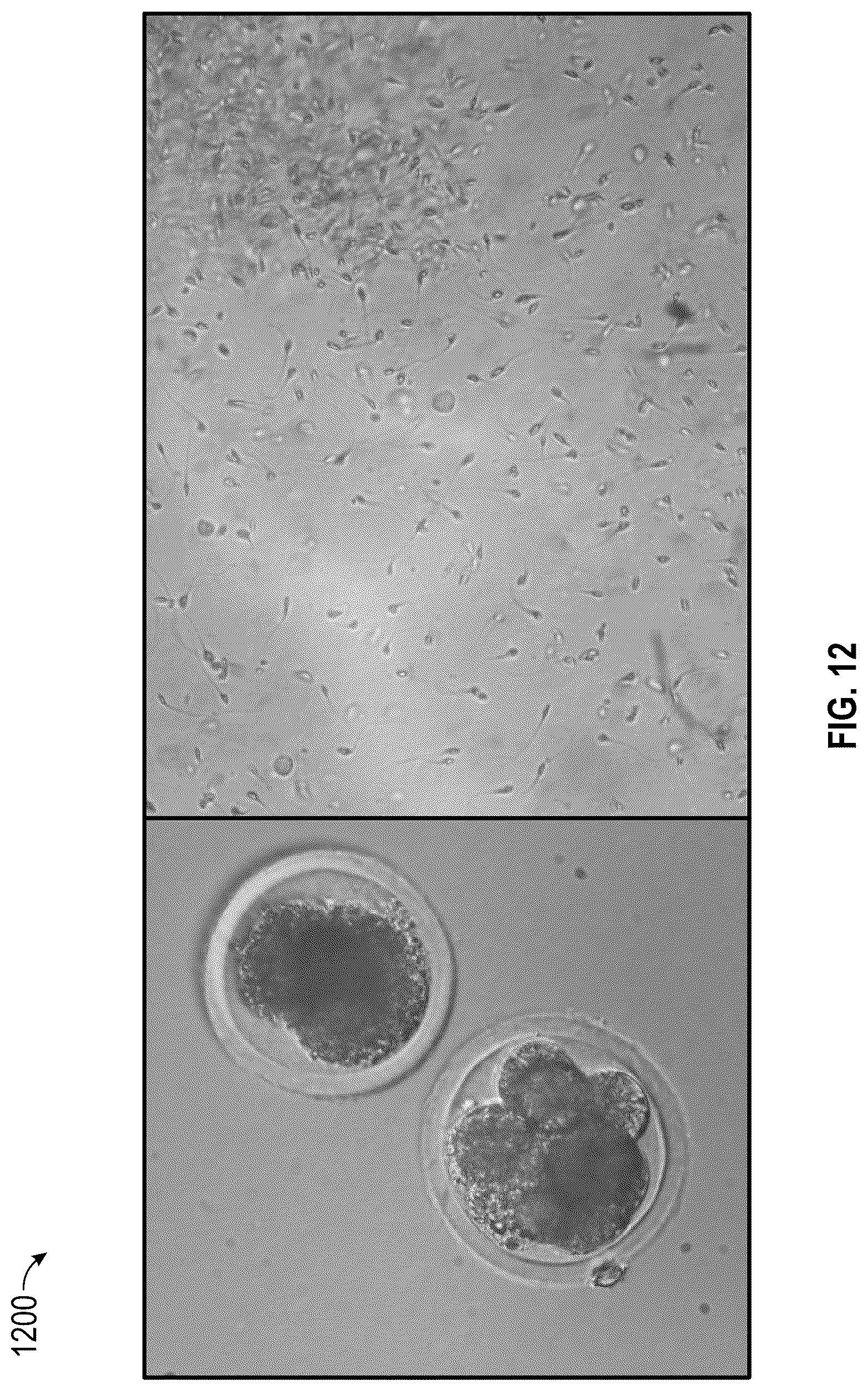 Patent US12310625 Figure 13 – Autonomous insemination in an intelligent automated in vitro fertilization and intracytoplasmic sperm injection platform