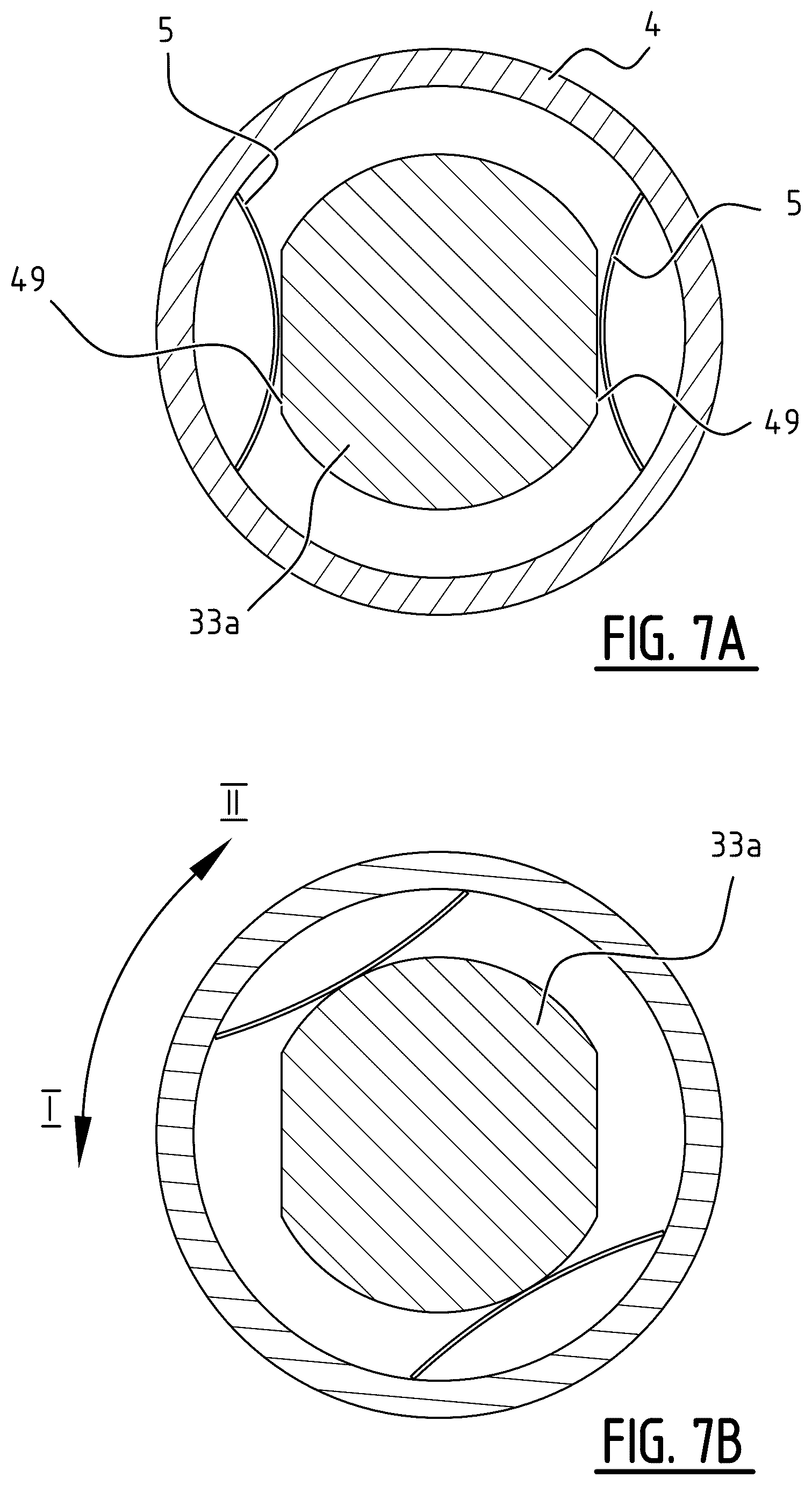 Patent US12310626 Figure 7 – External distractor and adjustment device for use in such a distractor