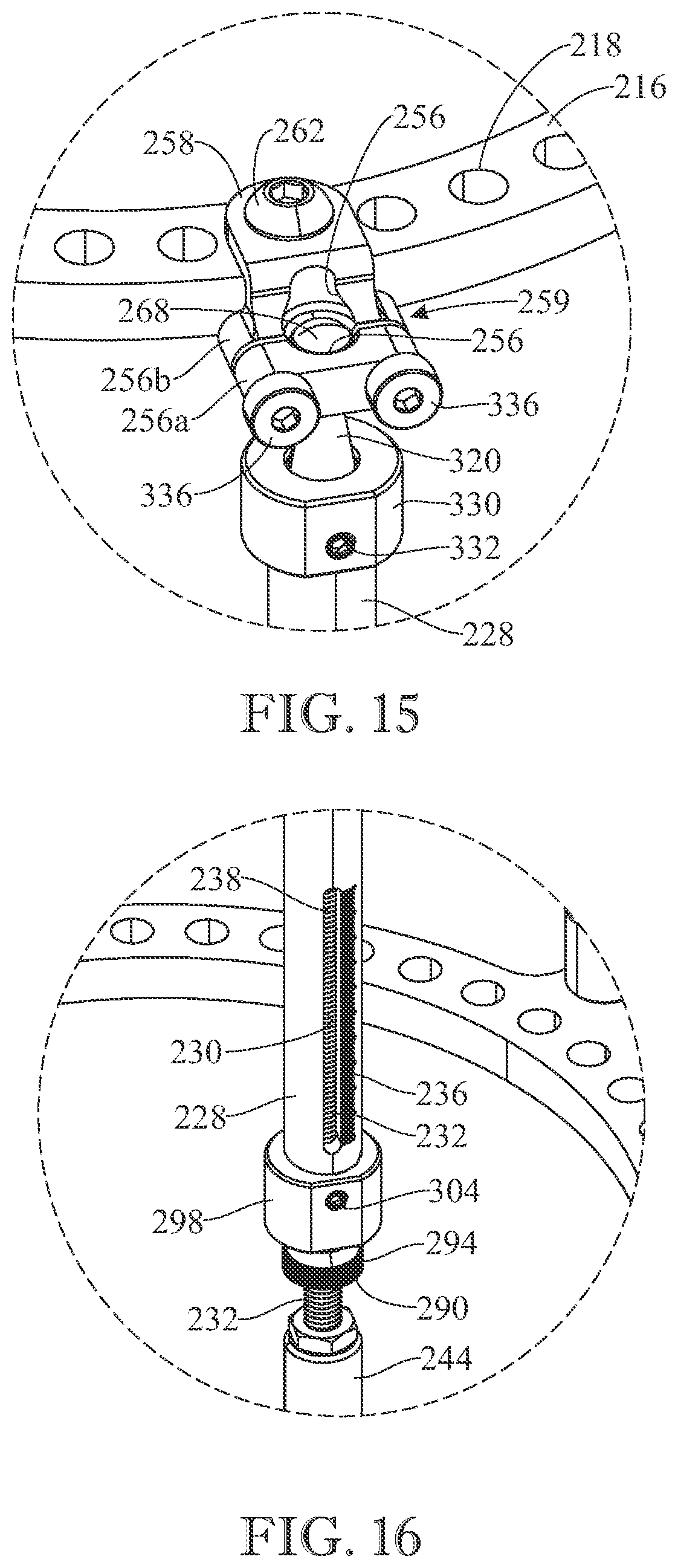 Patent US12310627 Figure 15 – External fixation device