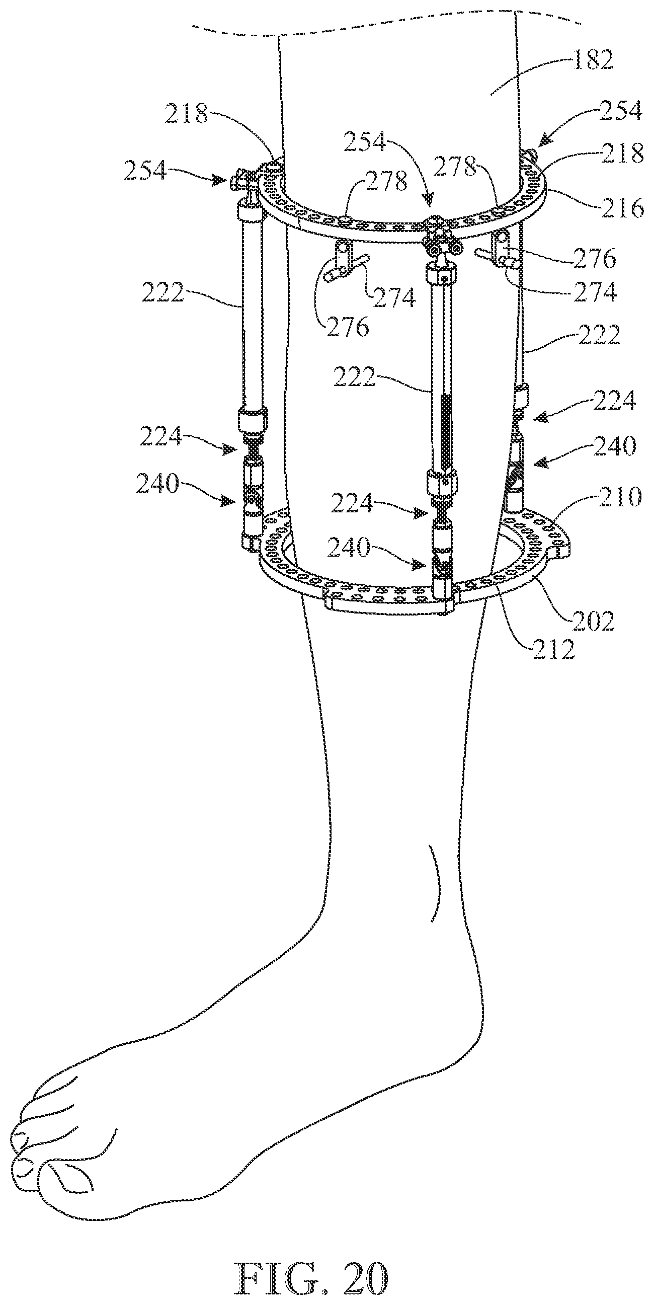 Patent US12310627 Figure 19 – External fixation device