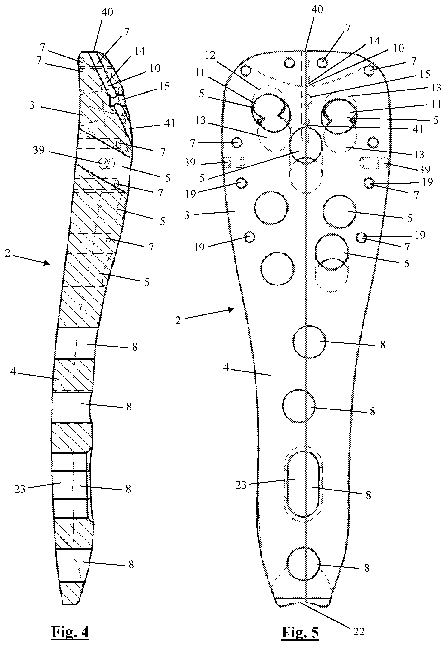 Patent US12310628 Figure 4 – Proximal humeral fixation plate and method for placing such a fixation plate
