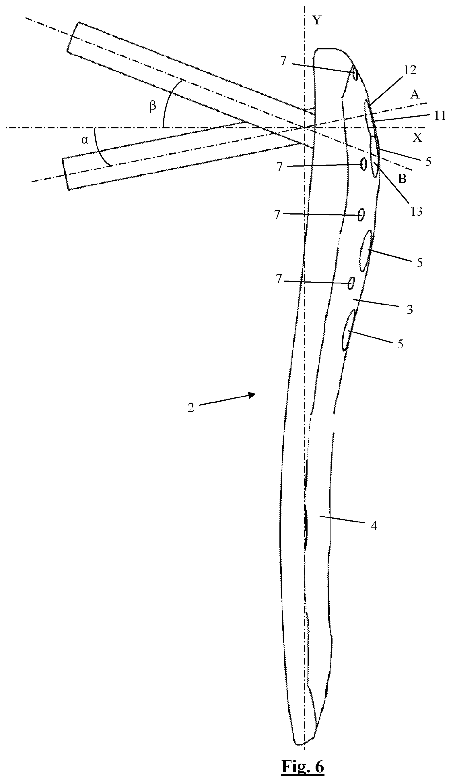 Patent US12310628 Figure 5 – Proximal humeral fixation plate and method for placing such a fixation plate