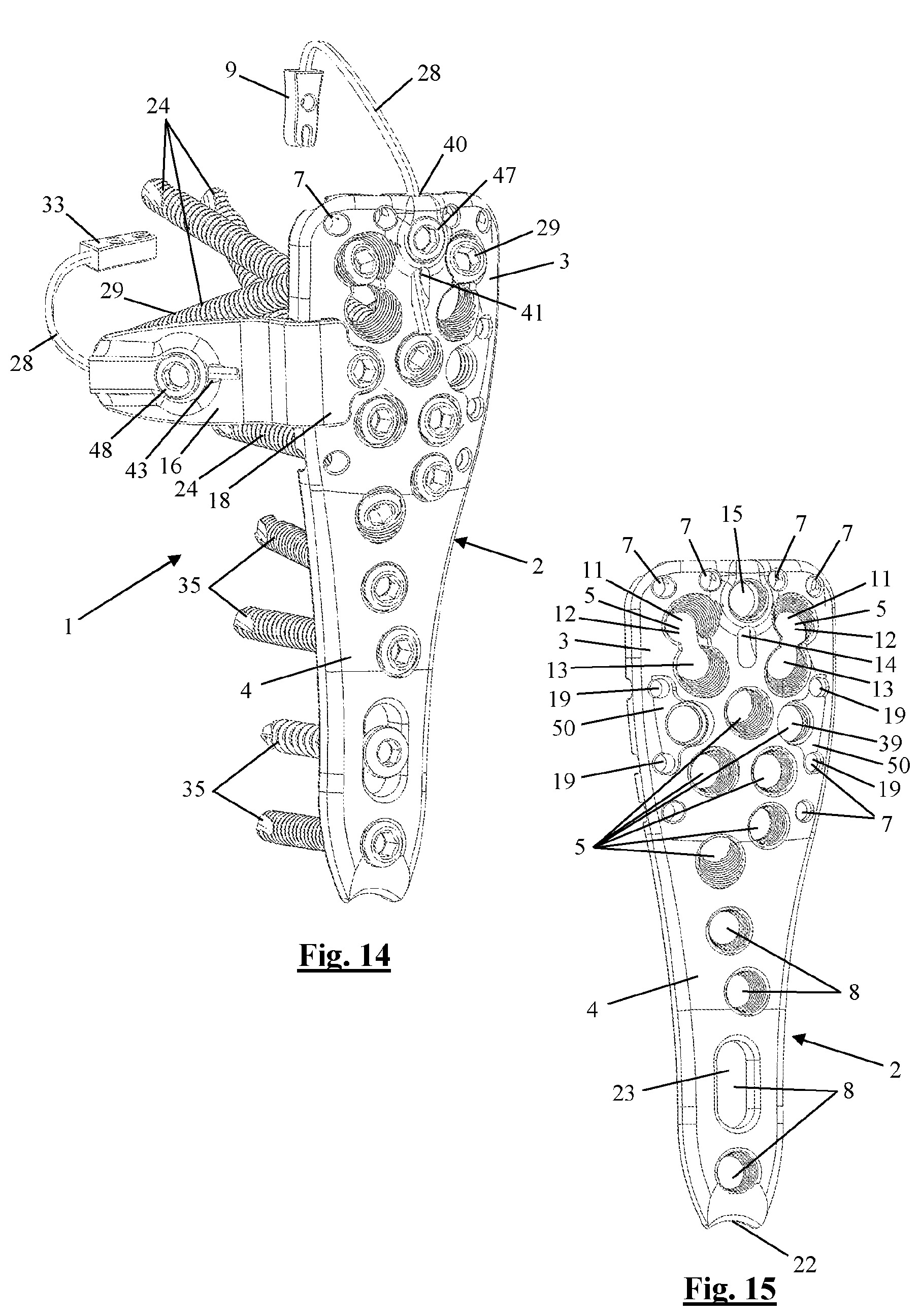 Patent US12310628 Figure 8 – Proximal humeral fixation plate and method for placing such a fixation plate