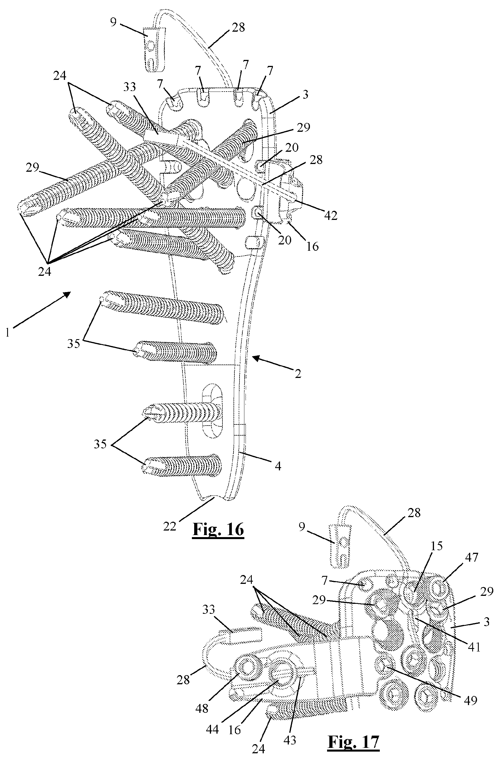 Patent US12310628 Figure 9 – Proximal humeral fixation plate and method for placing such a fixation plate