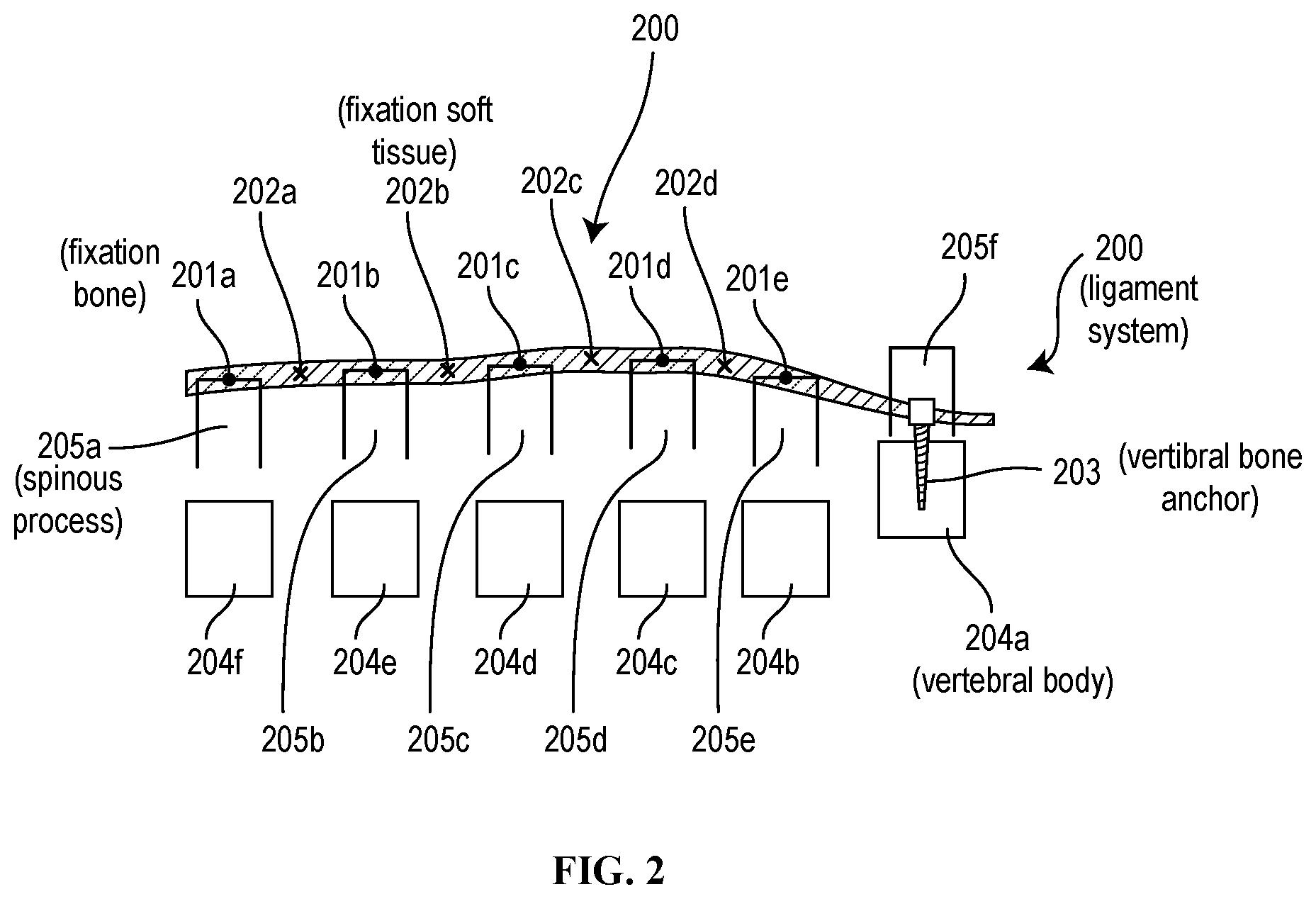 Patent US12310629 Figure 2 – Methods and devices for augmenting the spine