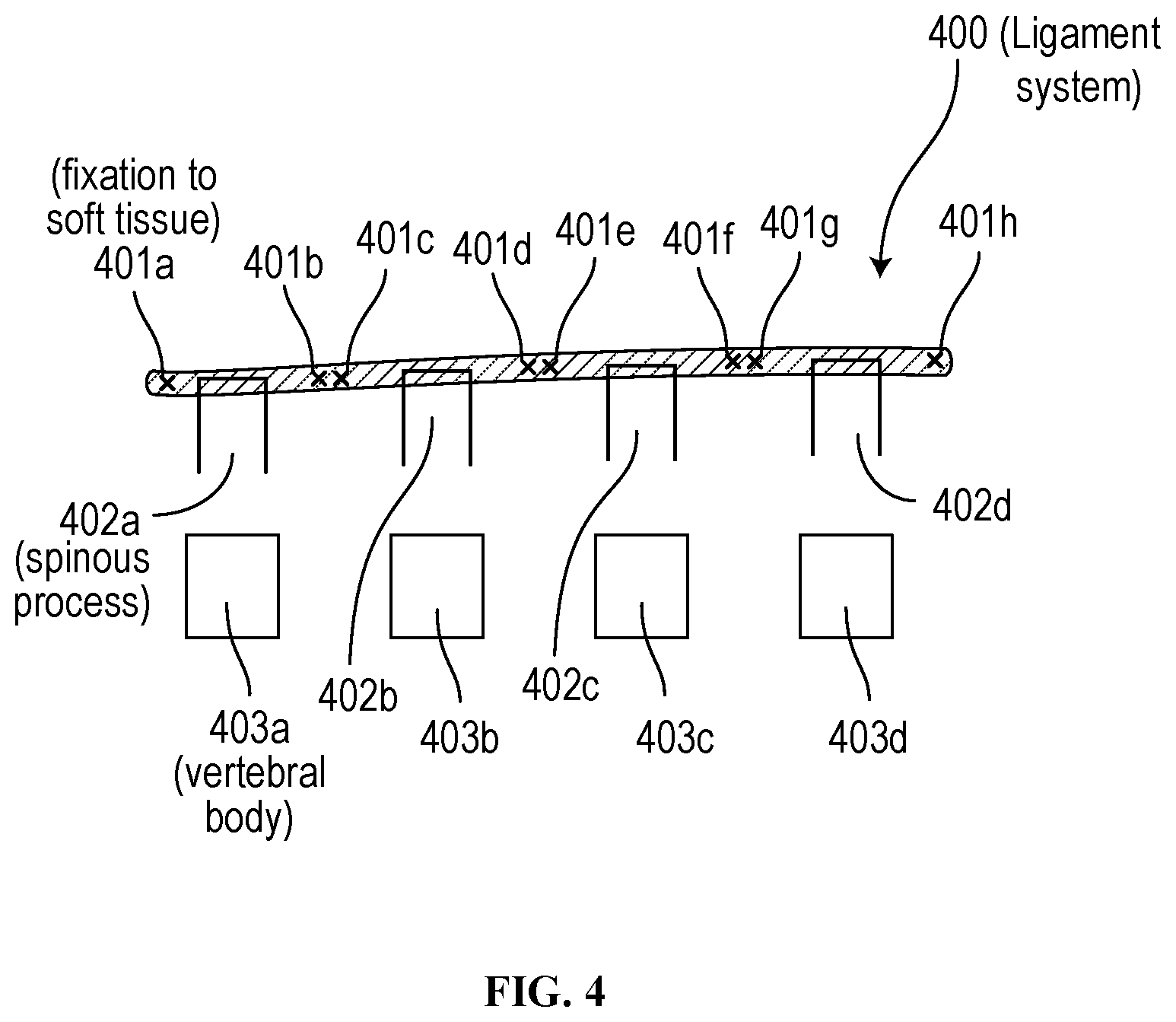 Patent US12310629 Figure 4 – Methods and devices for augmenting the spine