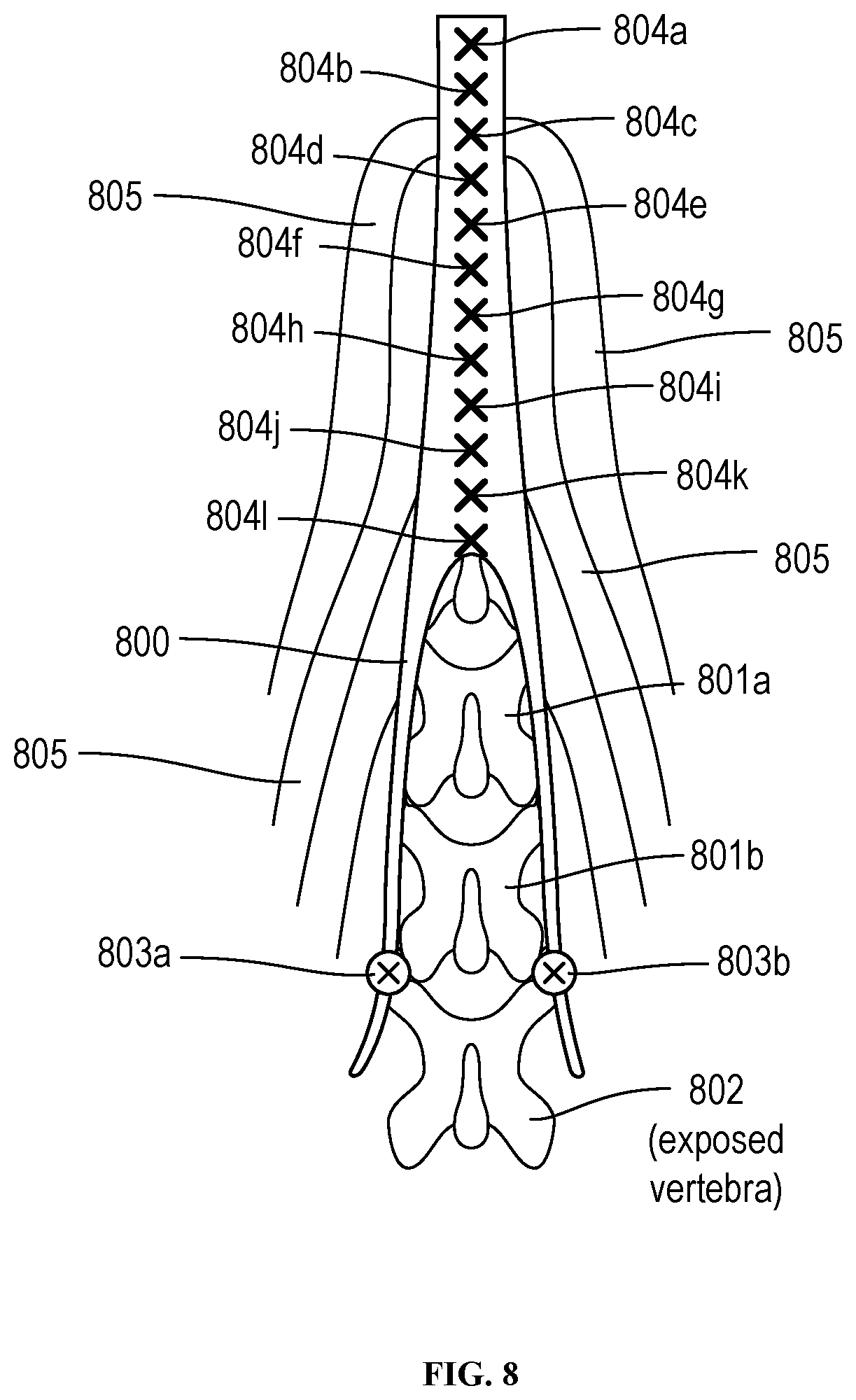 Patent US12310629 Figure 8 – Methods and devices for augmenting the spine