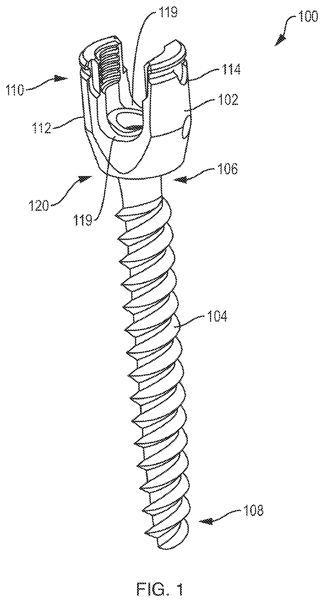Patent US12310631 Figure 1 – Multi-feature polyaxial screw