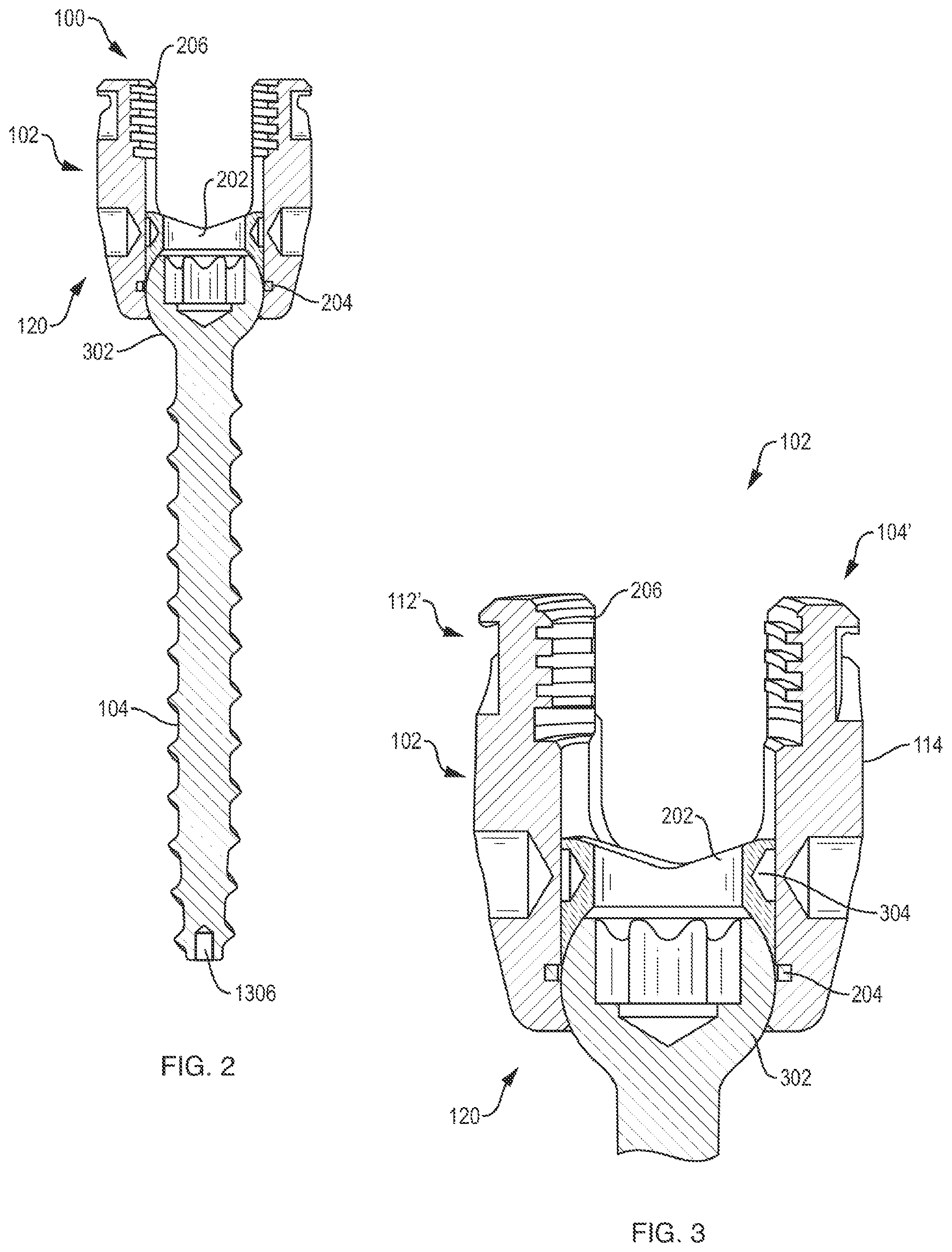 Patent US12310631 Figure 2 – Multi-feature polyaxial screw