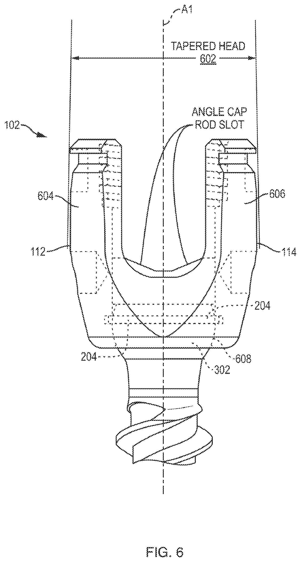 Patent US12310631 Figure 5 – Multi-feature polyaxial screw