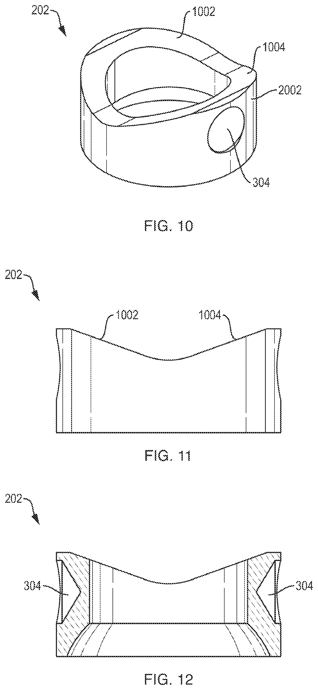 Patent US12310631 Figure 8 – Multi-feature polyaxial screw