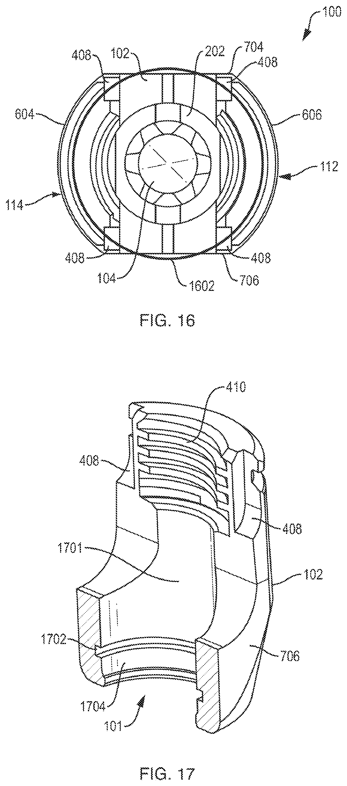 Patent US12310631 Figure 11 – Multi-feature polyaxial screw