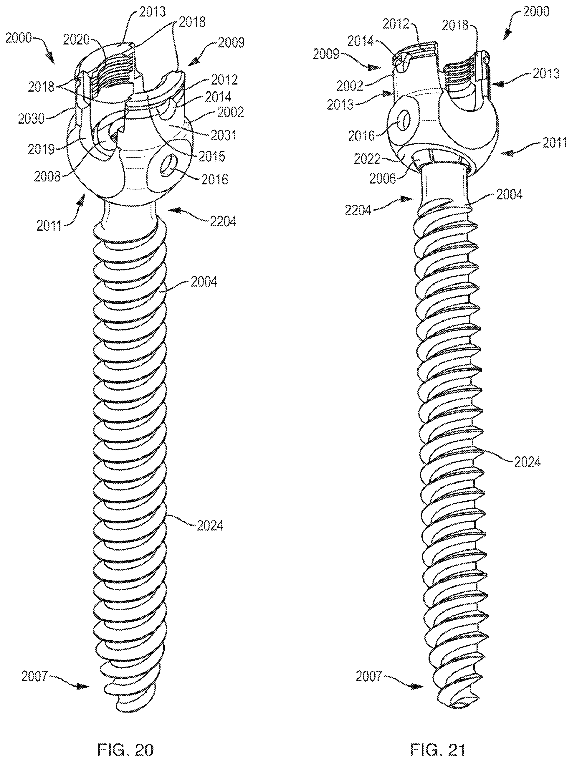 Patent US12310631 Figure 13 – Multi-feature polyaxial screw