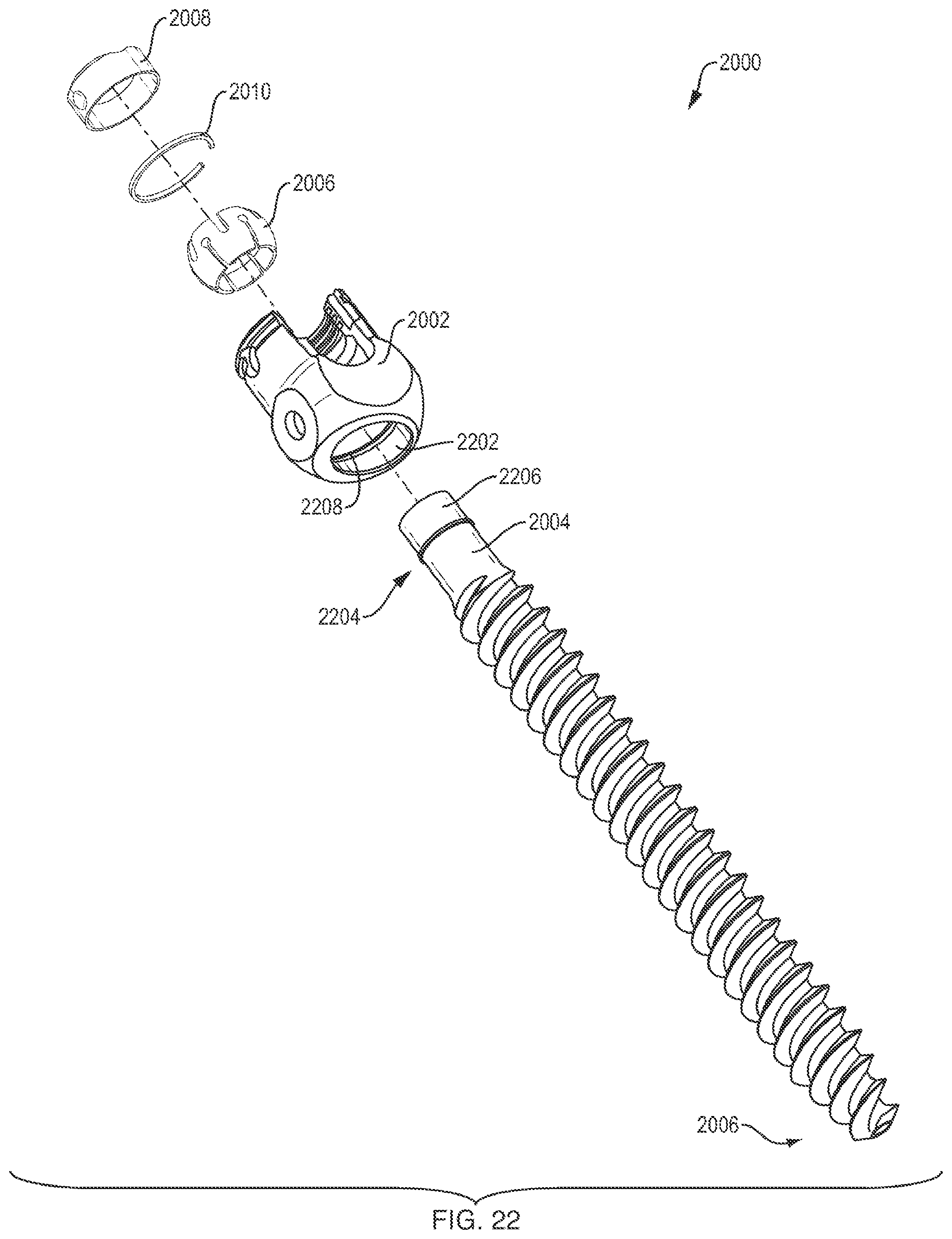Patent US12310631 Figure 14 – Multi-feature polyaxial screw