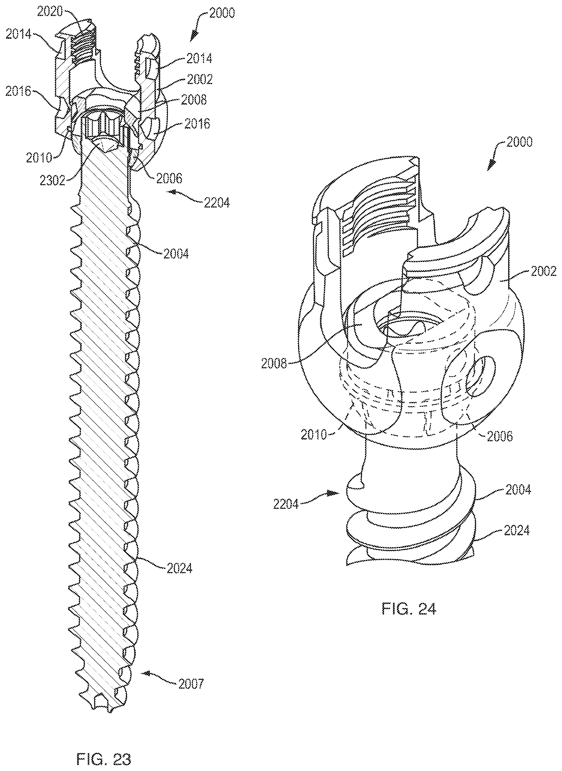 Patent US12310631 Figure 15 – Multi-feature polyaxial screw