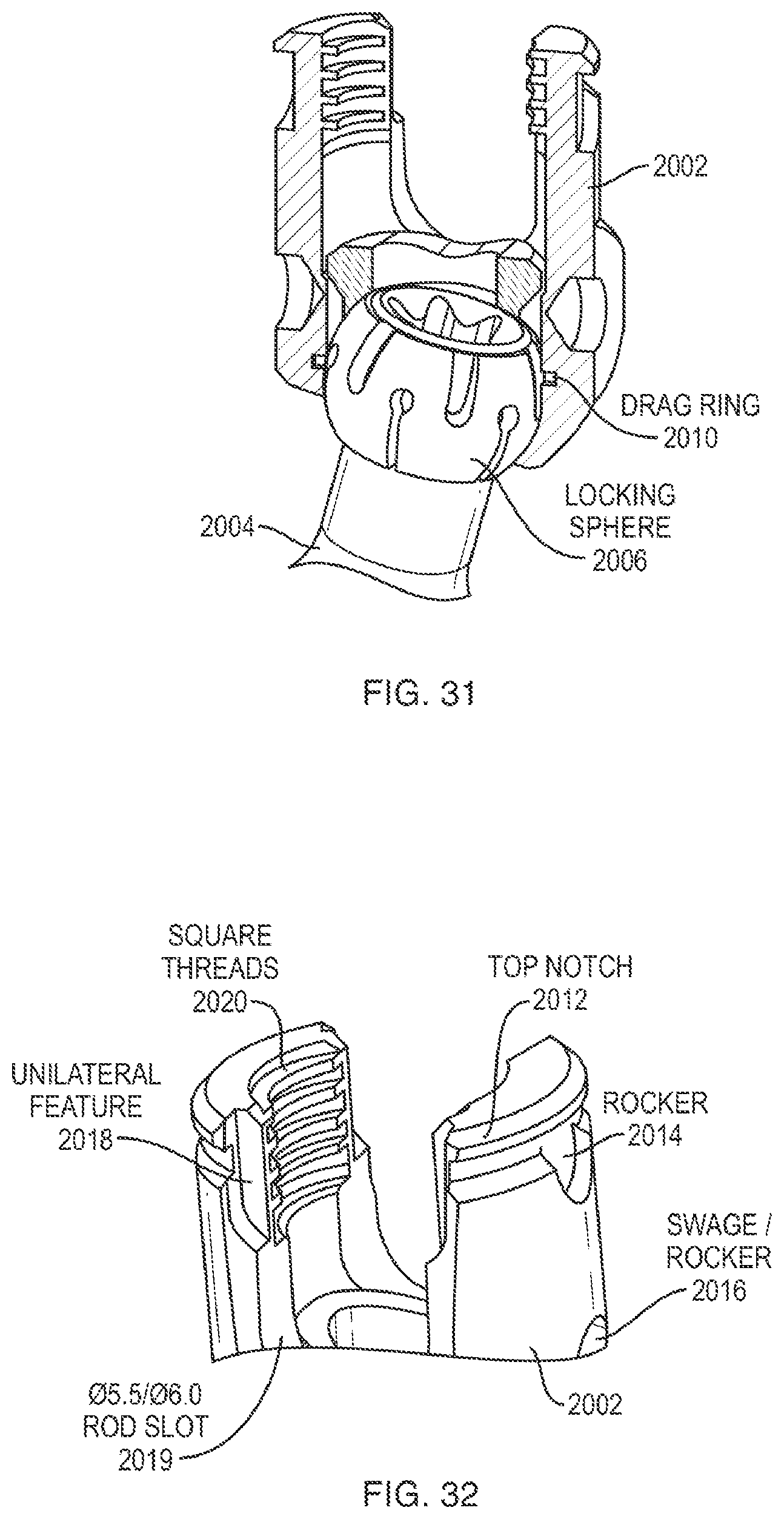 Patent US12310631 Figure 18 – Multi-feature polyaxial screw