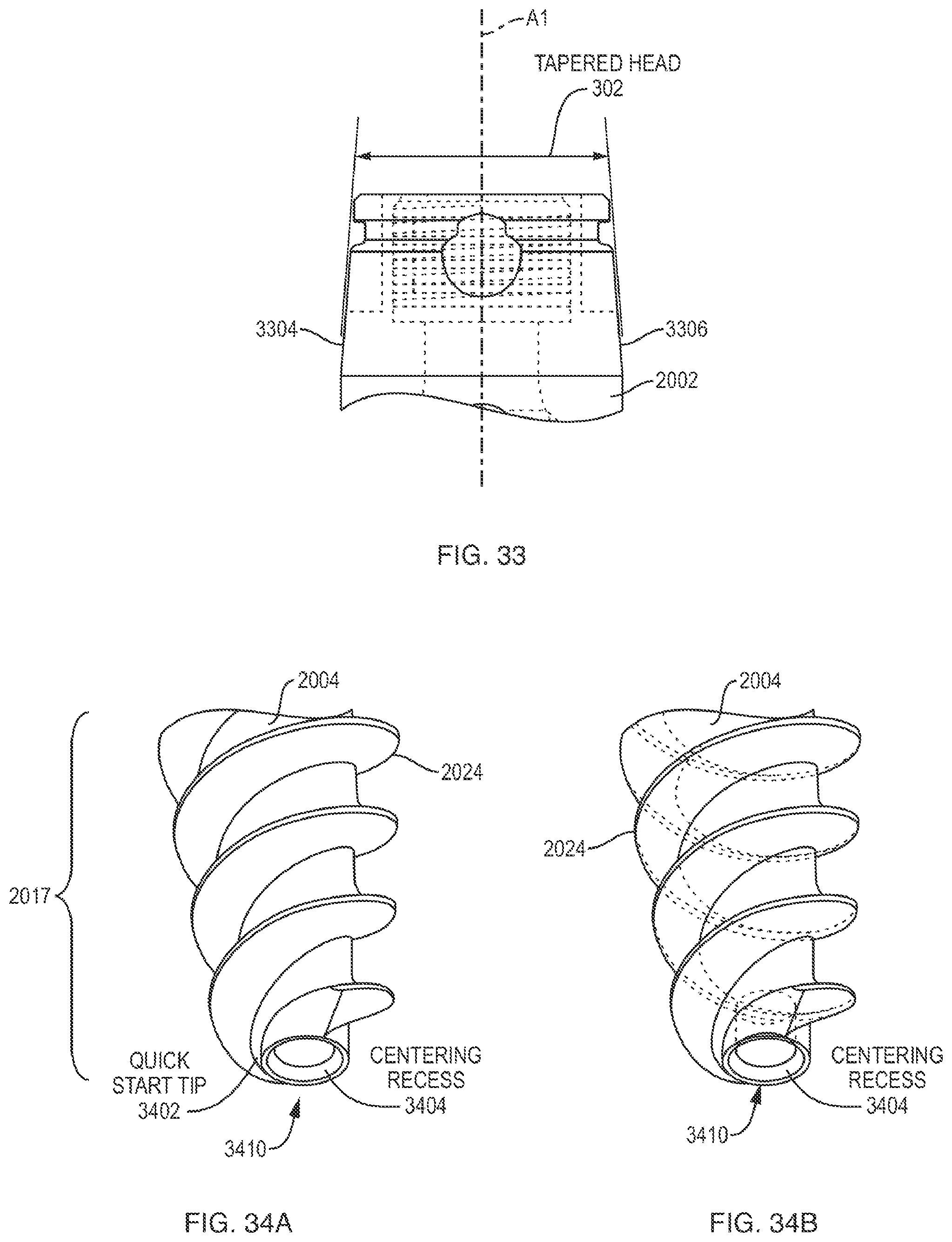 Patent US12310631 Figure 19 – Multi-feature polyaxial screw