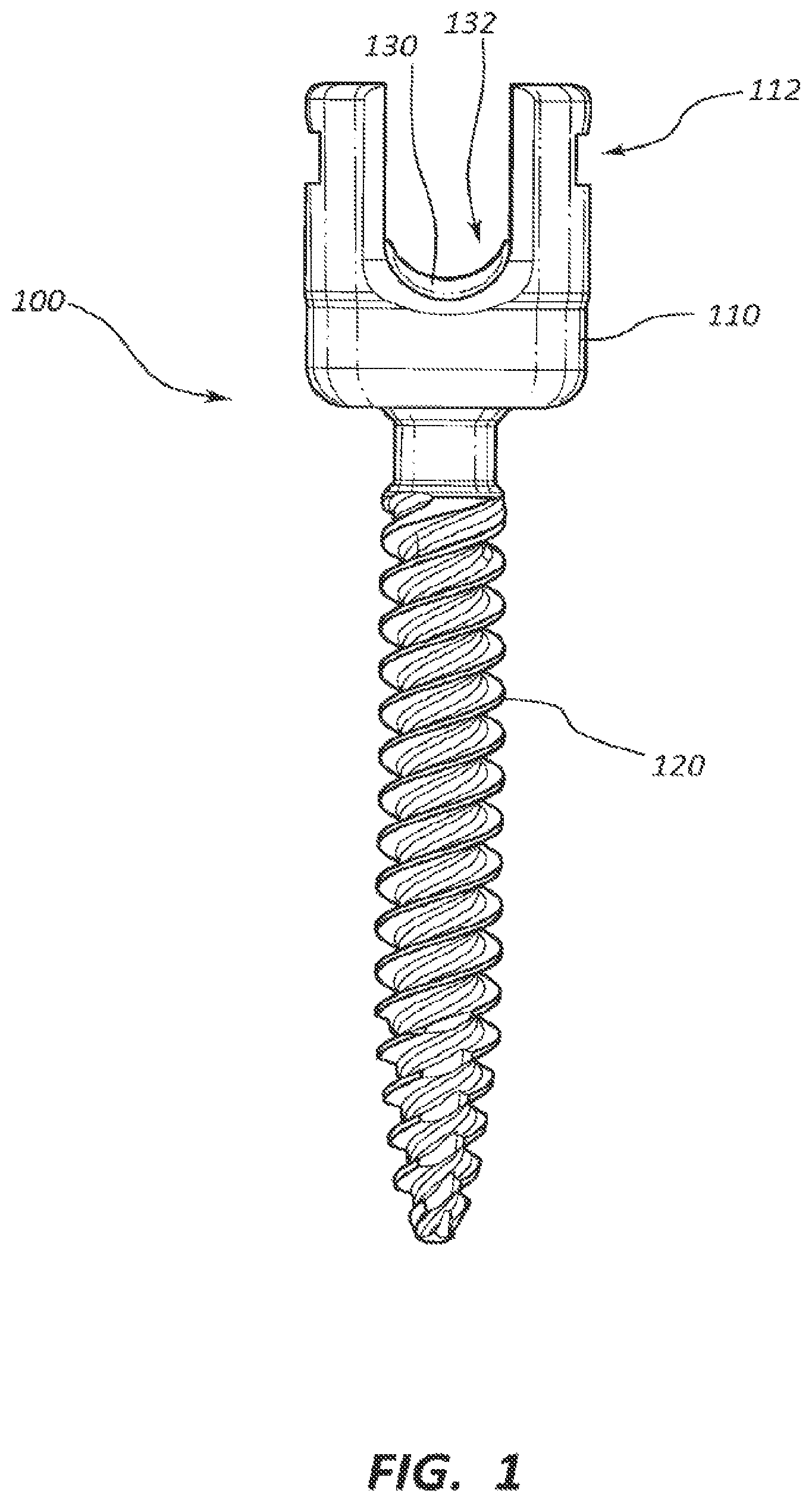 Patent US12310632 Figure 1 – Spring cage spinal fixation systems