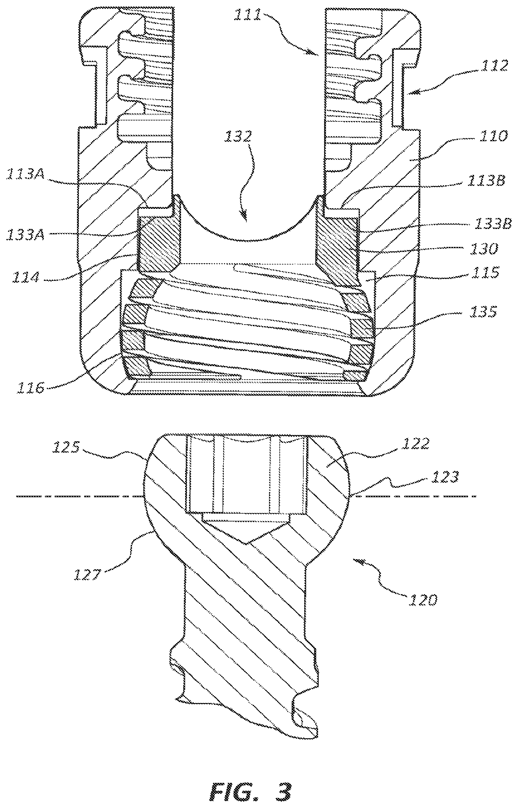 Patent US12310632 Figure 3 – Spring cage spinal fixation systems