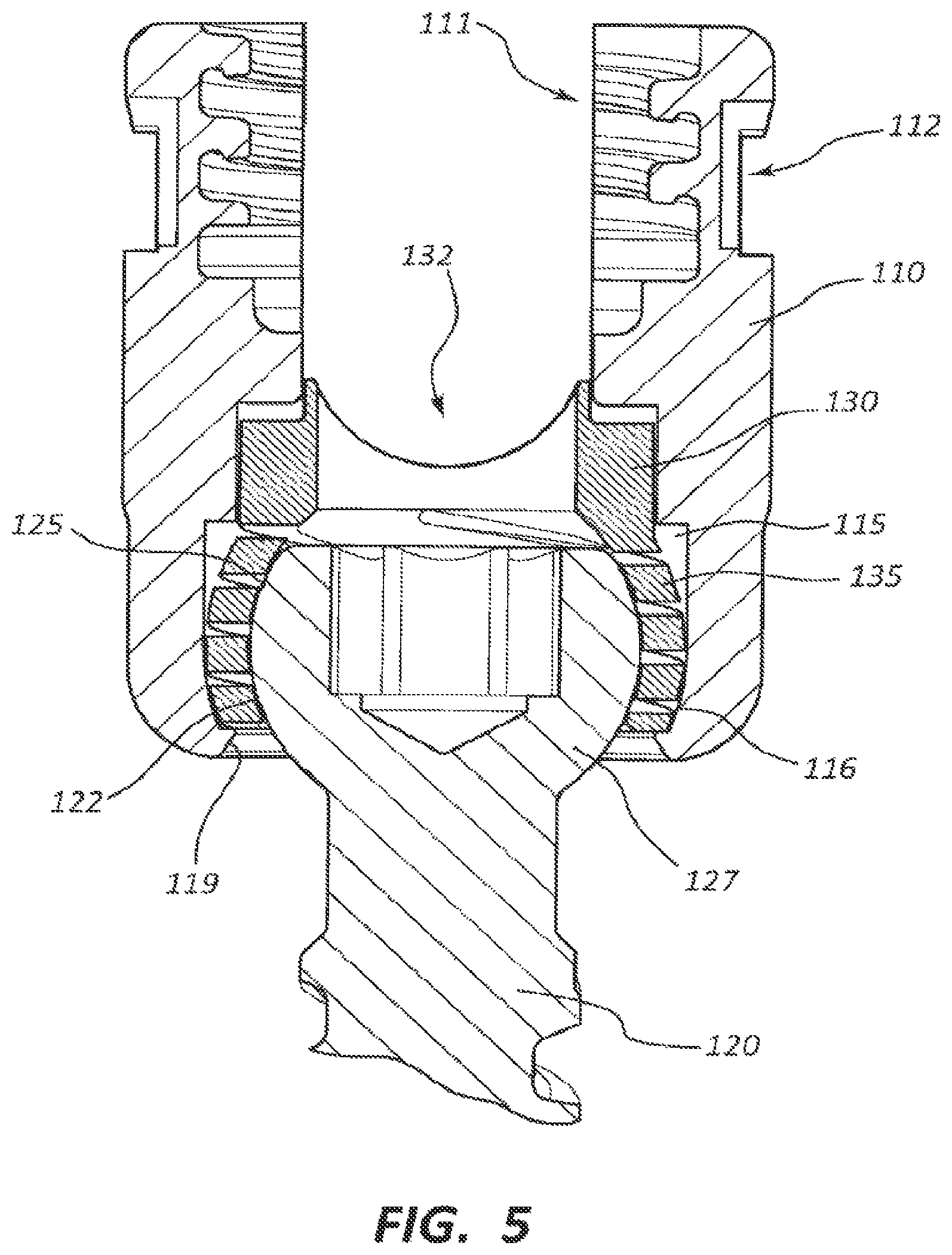Patent US12310632 Figure 5 – Spring cage spinal fixation systems