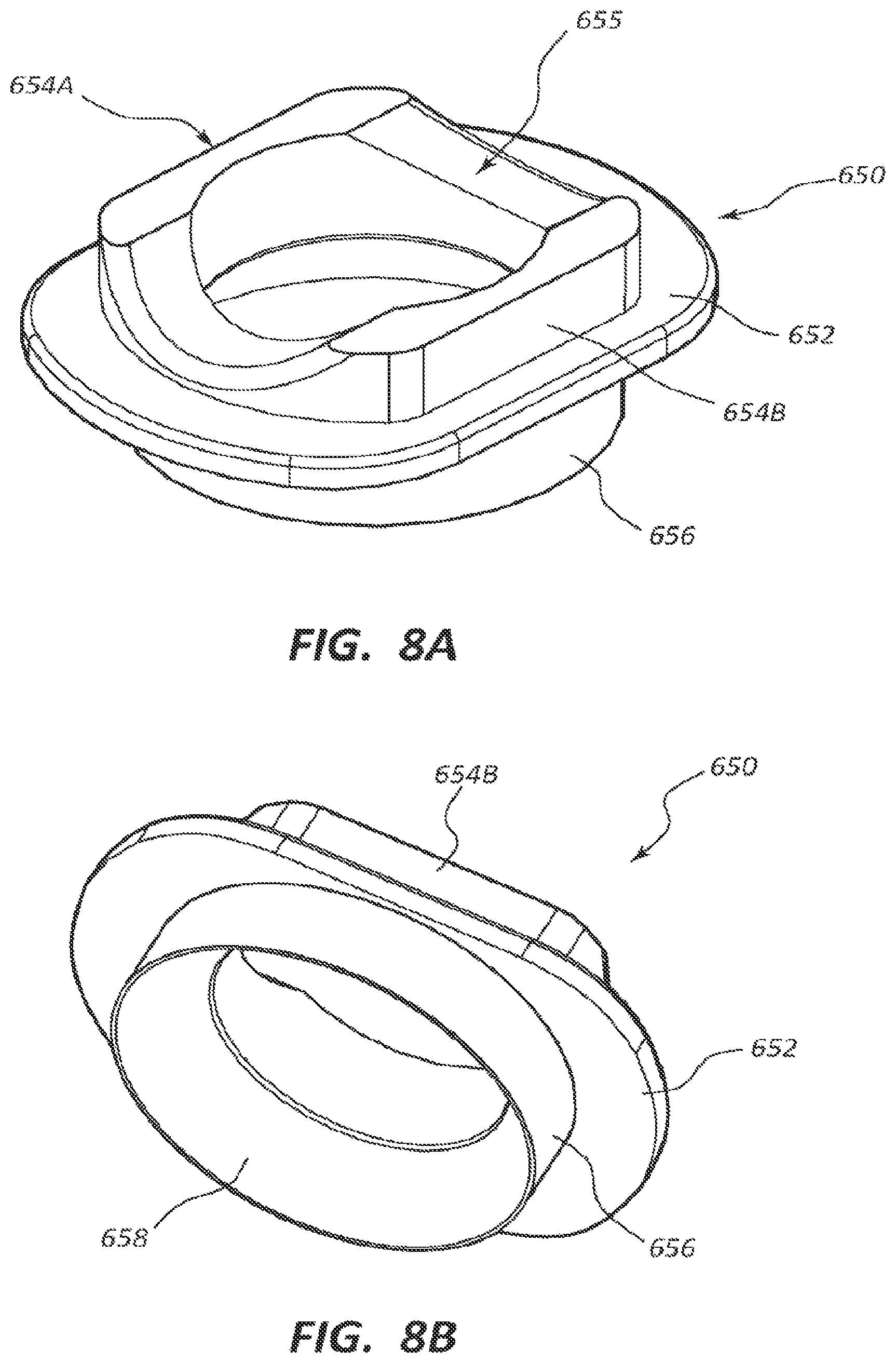 Patent US12310632 Figure 8 – Spring cage spinal fixation systems