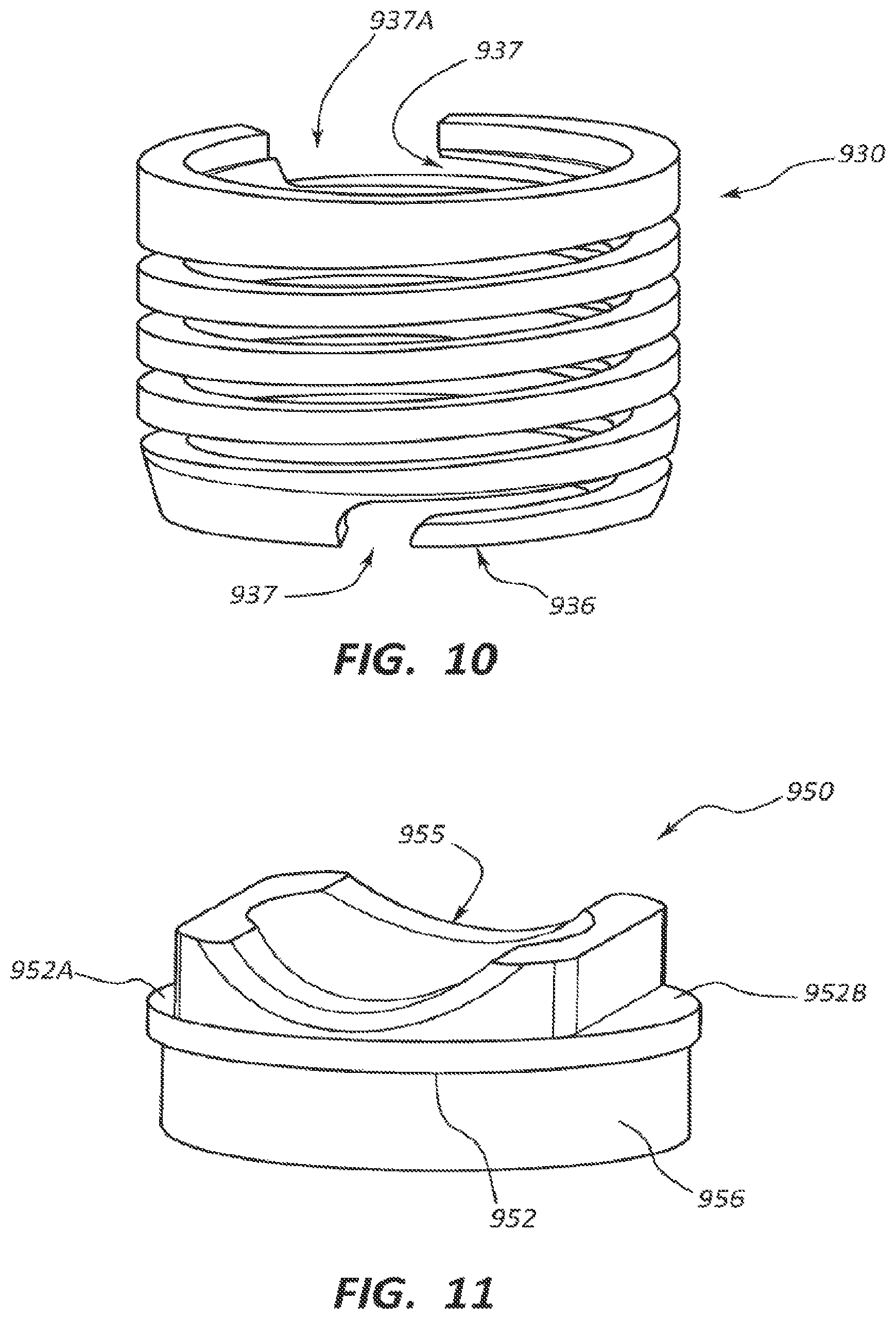 Patent US12310632 Figure 10 – Spring cage spinal fixation systems