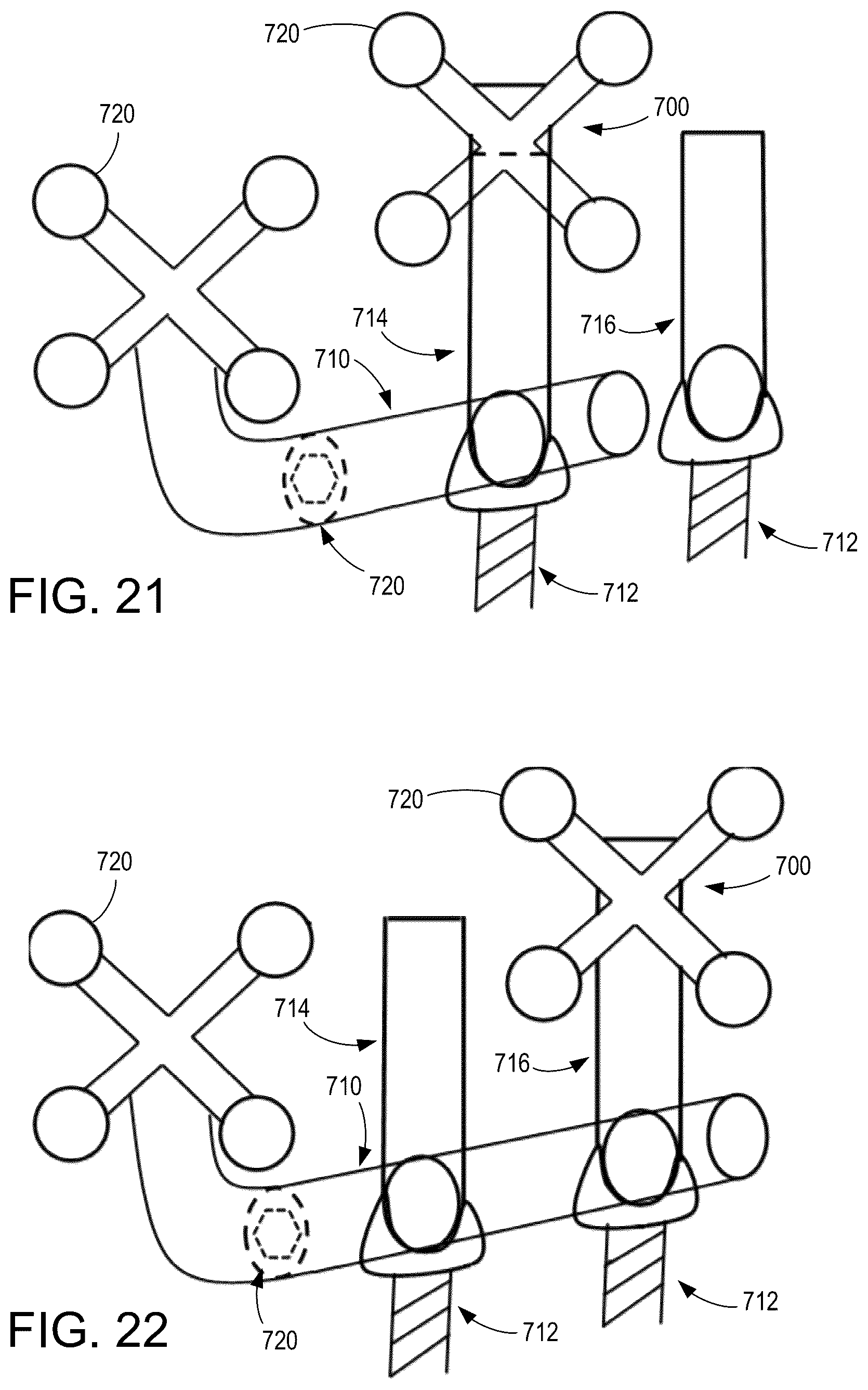 Patent US12310634 Figure 11 – Screw tower and rod reduction tool