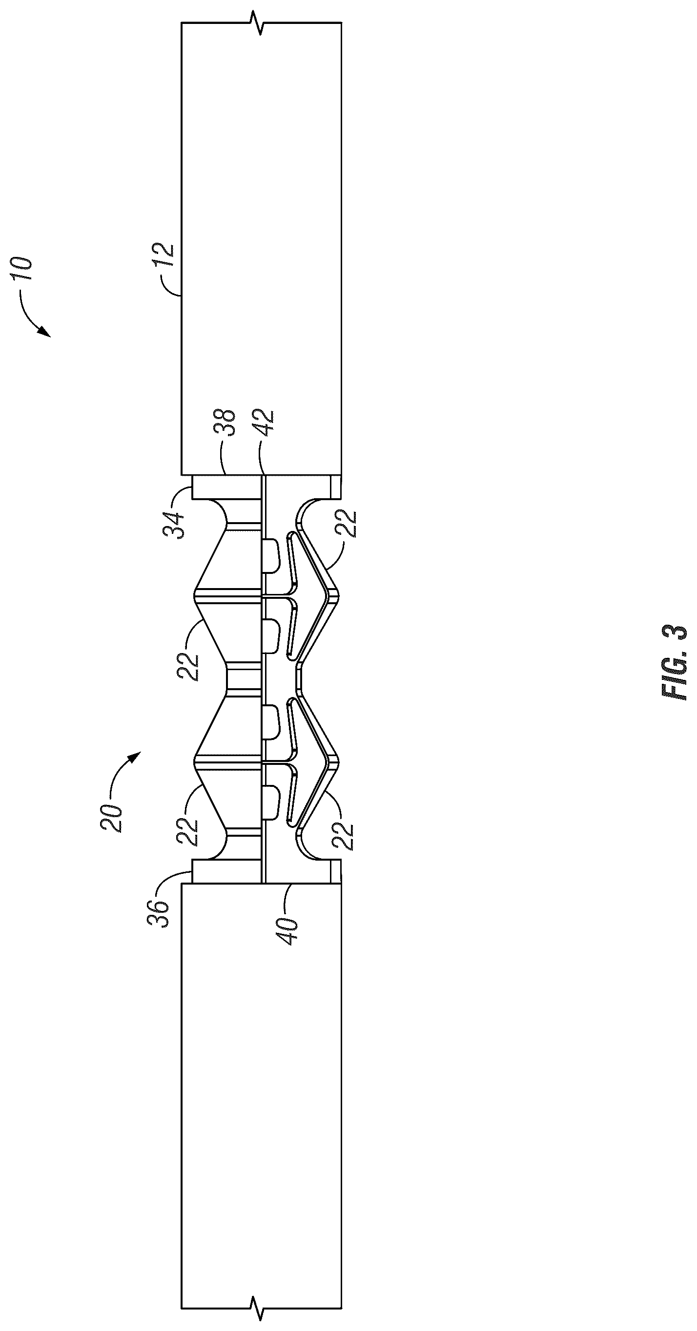 Patent US12310635 Figure 3 – Tunable stiffness bone rod