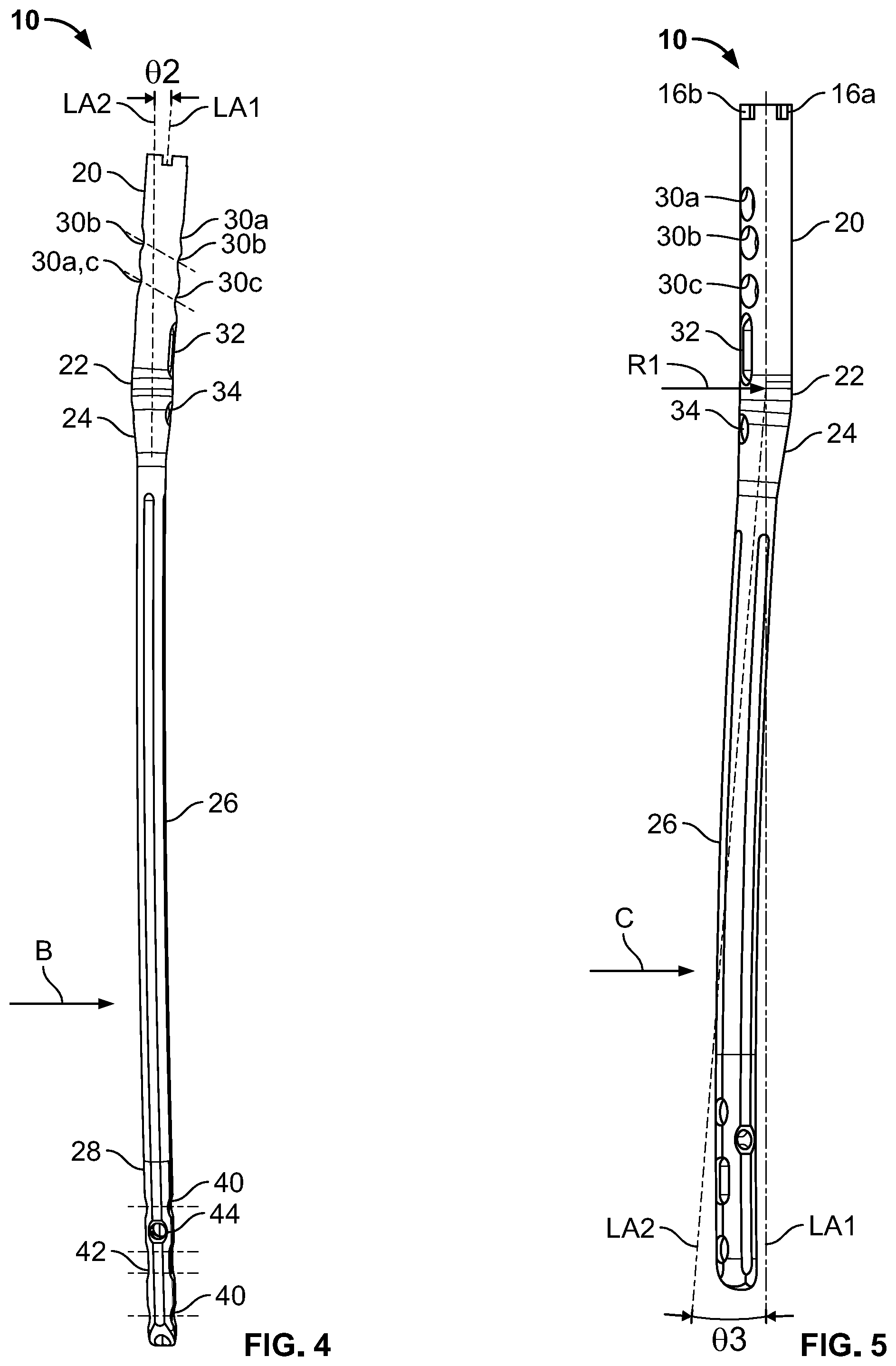 Patent US12310636 Figure 3 – Femoral nail with enhanced bone conforming geometry