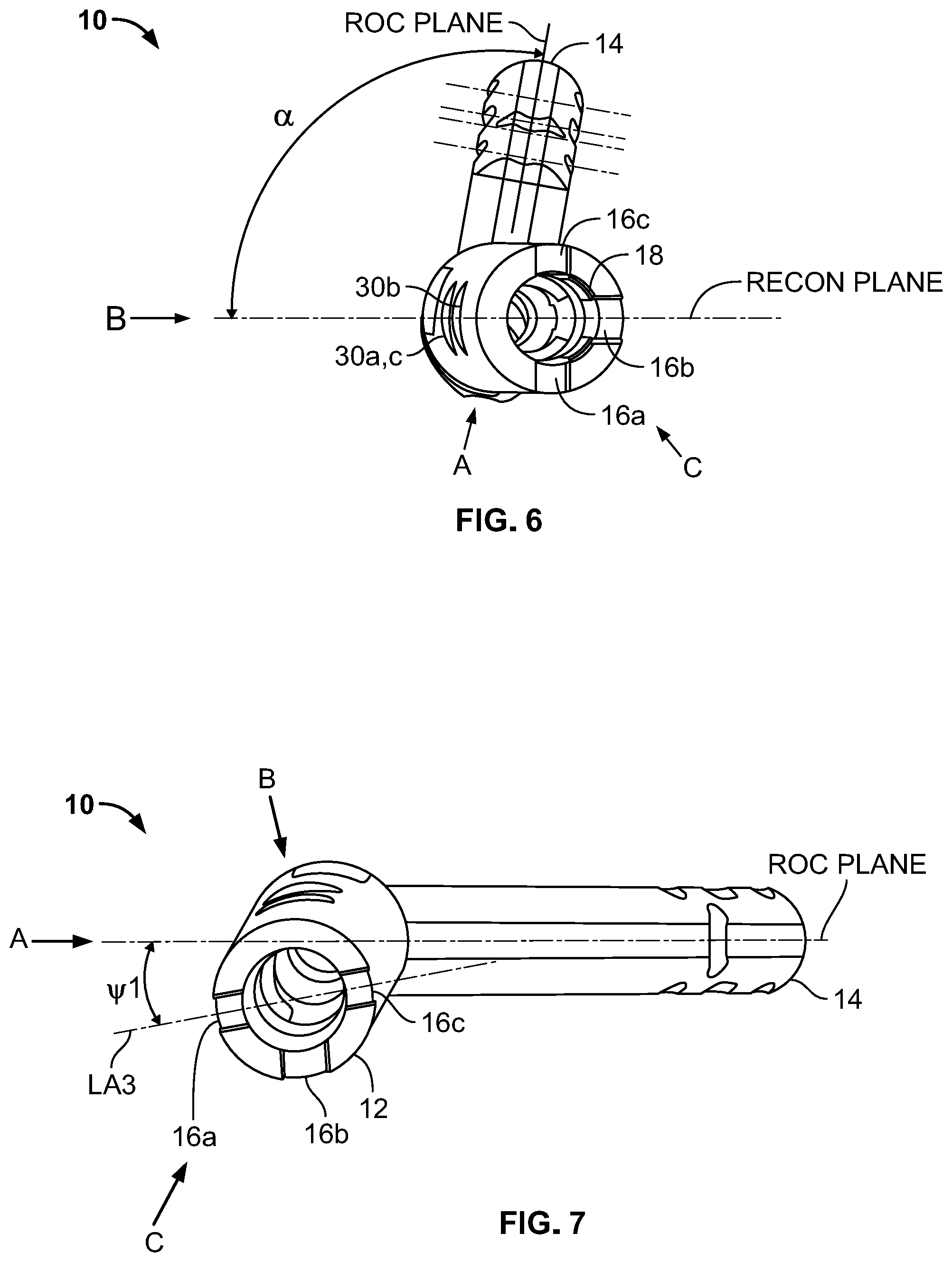 Patent US12310636 Figure 4 – Femoral nail with enhanced bone conforming geometry
