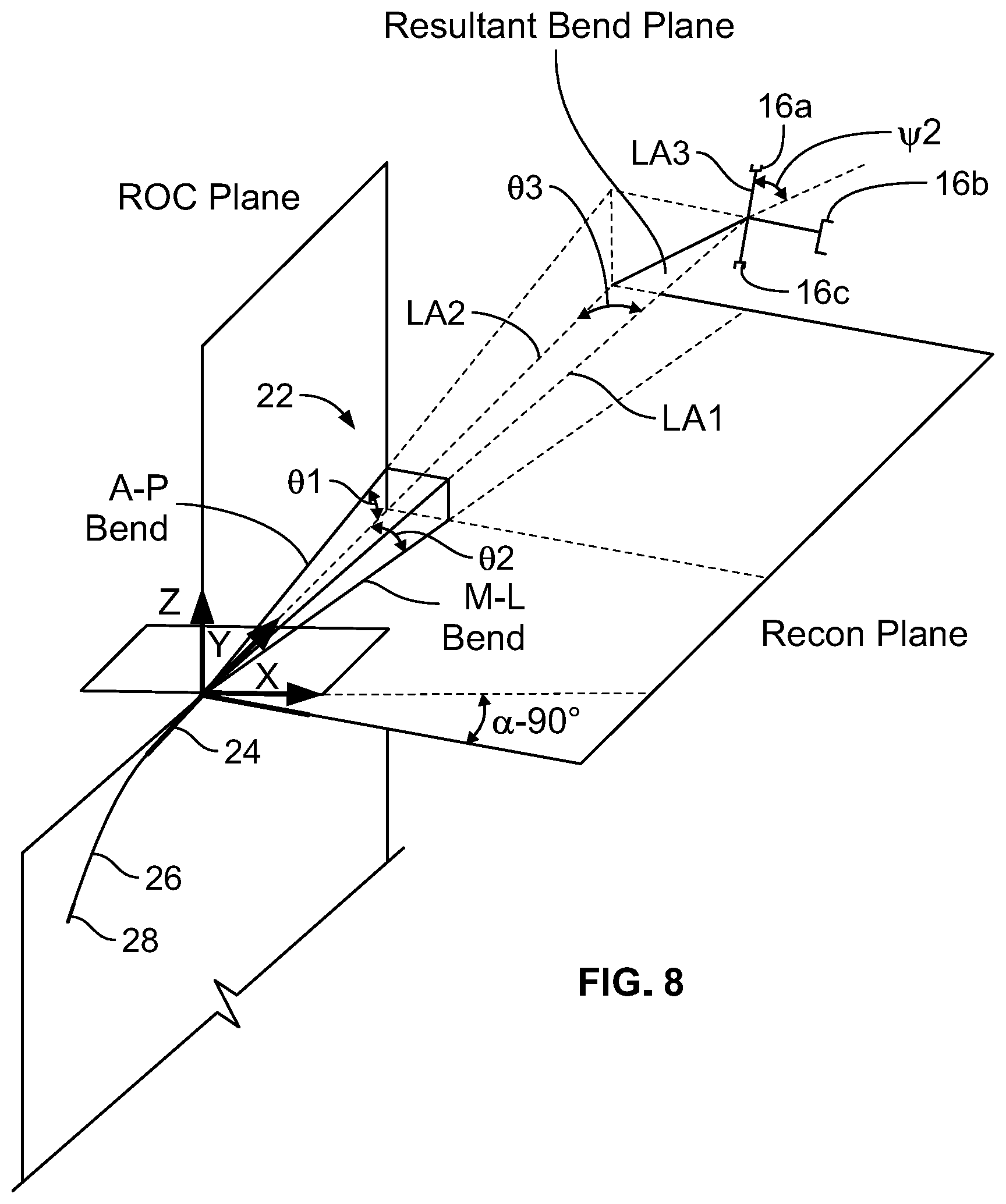 Patent US12310636 Figure 5 – Femoral nail with enhanced bone conforming geometry