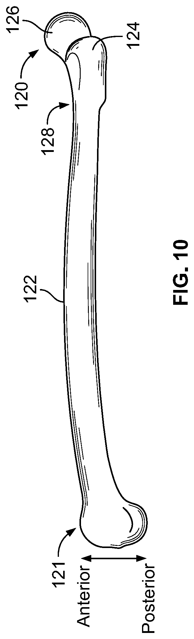 Patent US12310636 Figure 7 – Femoral nail with enhanced bone conforming geometry