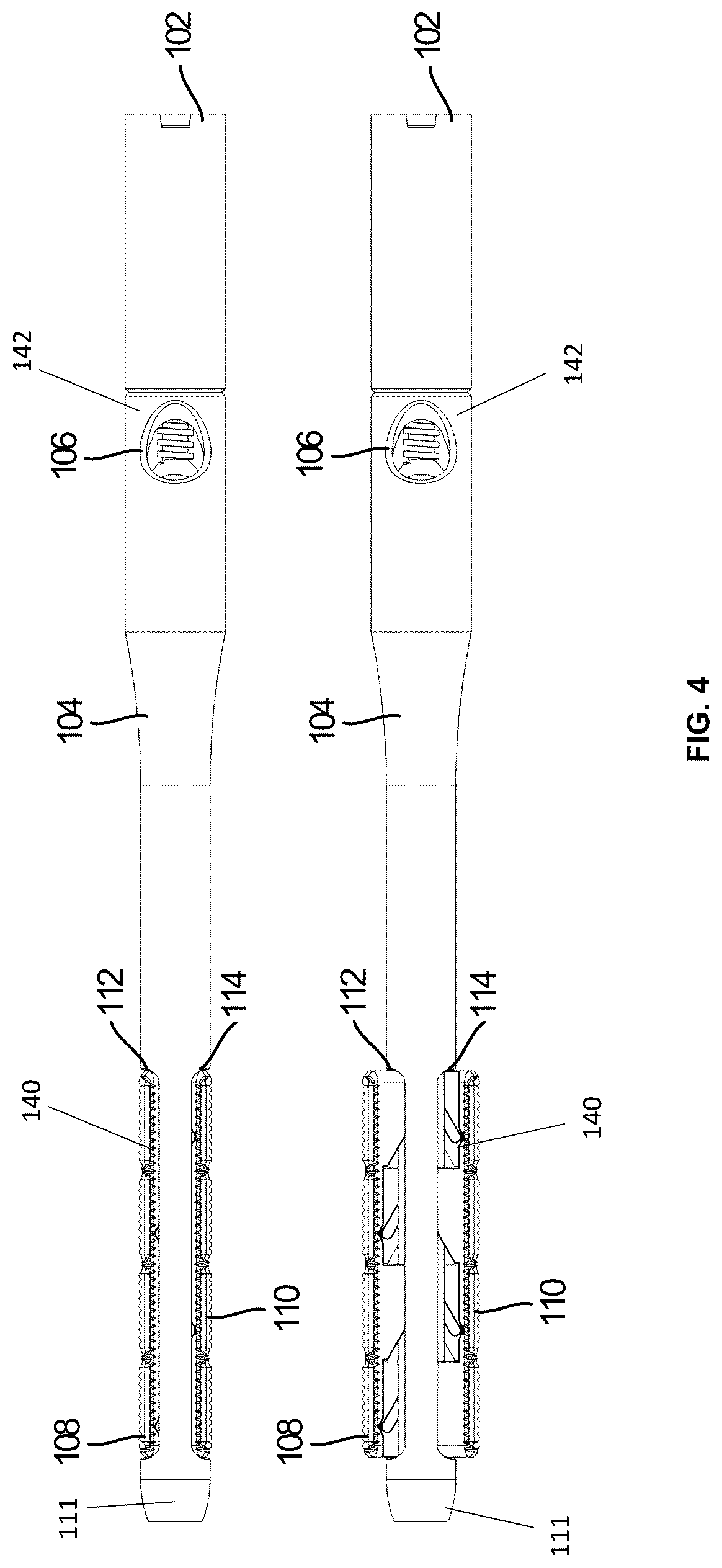 Patent US12310637 Figure 4 – Expandable intramedullary systems and methods of using the same