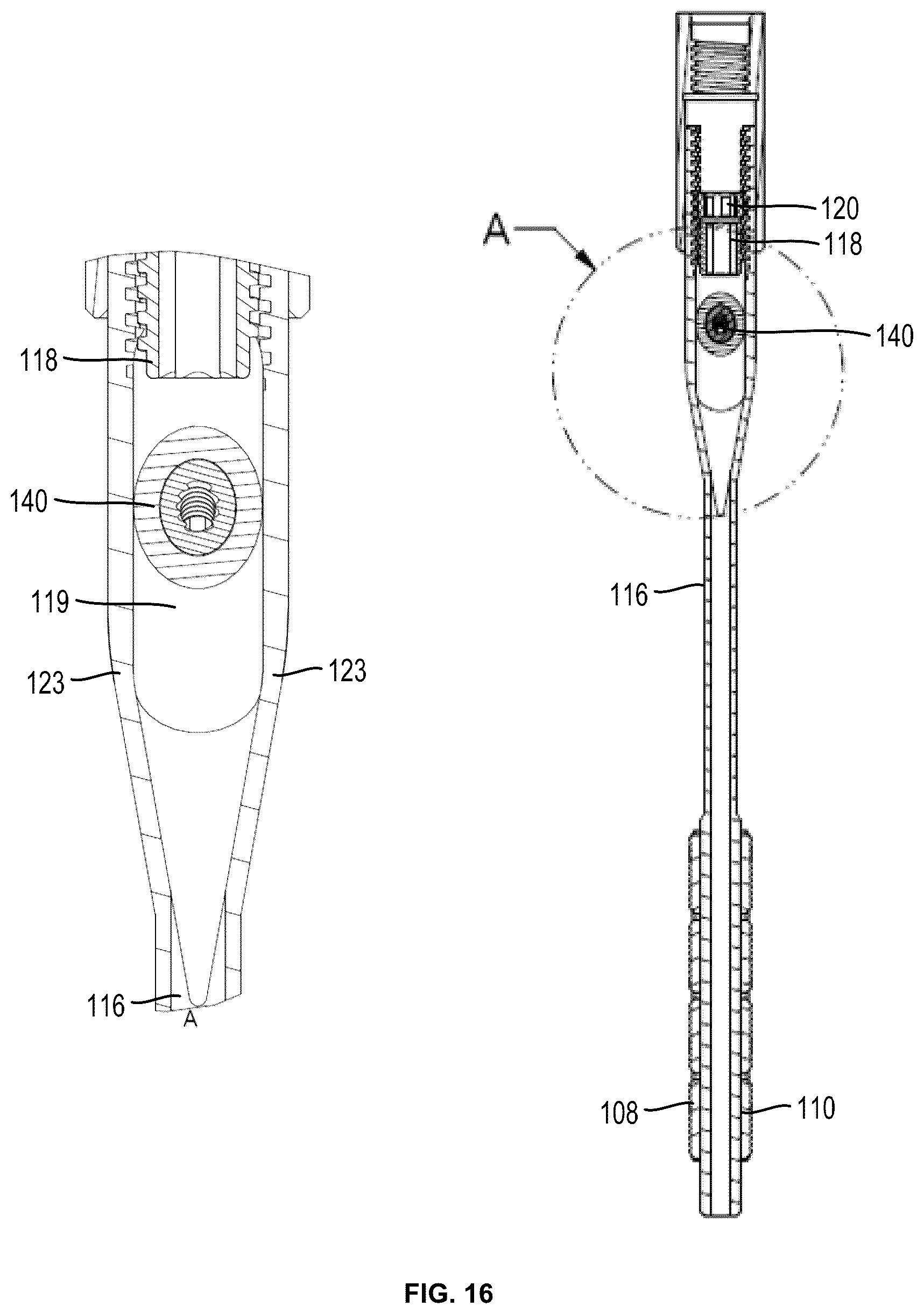 Patent US12310637 Figure 14 – Expandable intramedullary systems and methods of using the same