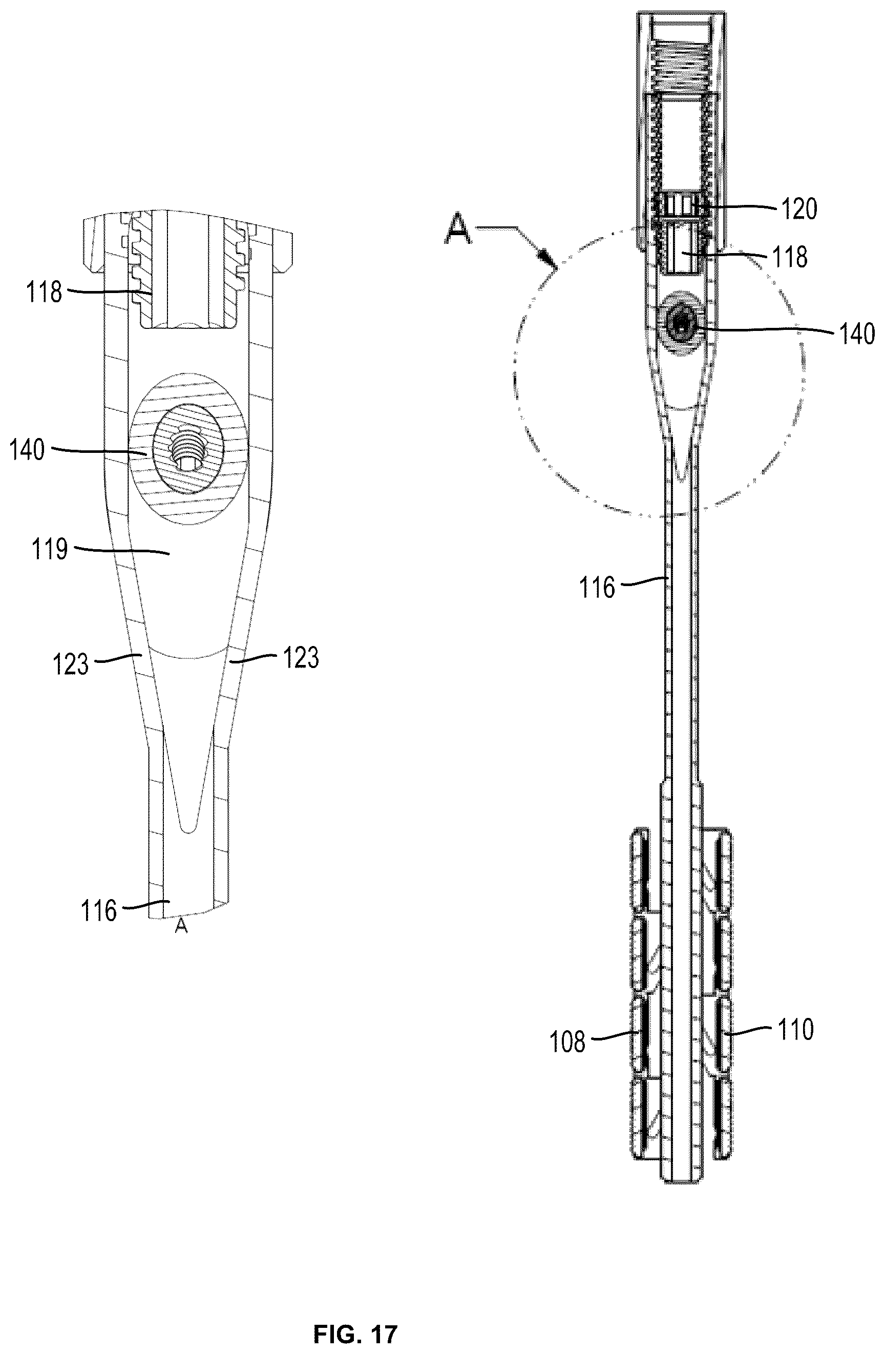Patent US12310637 Figure 15 – Expandable intramedullary systems and methods of using the same