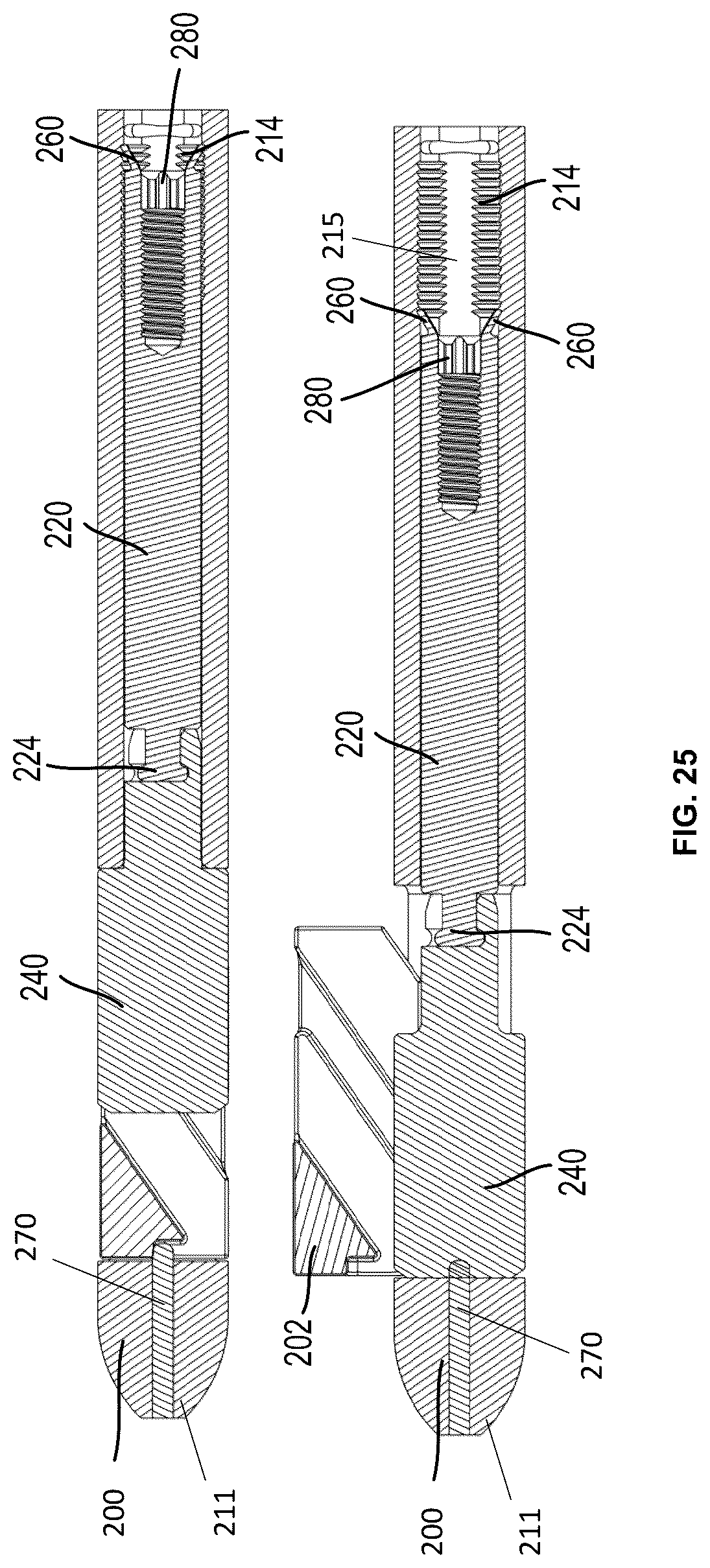 Patent US12310637 Figure 19 – Expandable intramedullary systems and methods of using the same