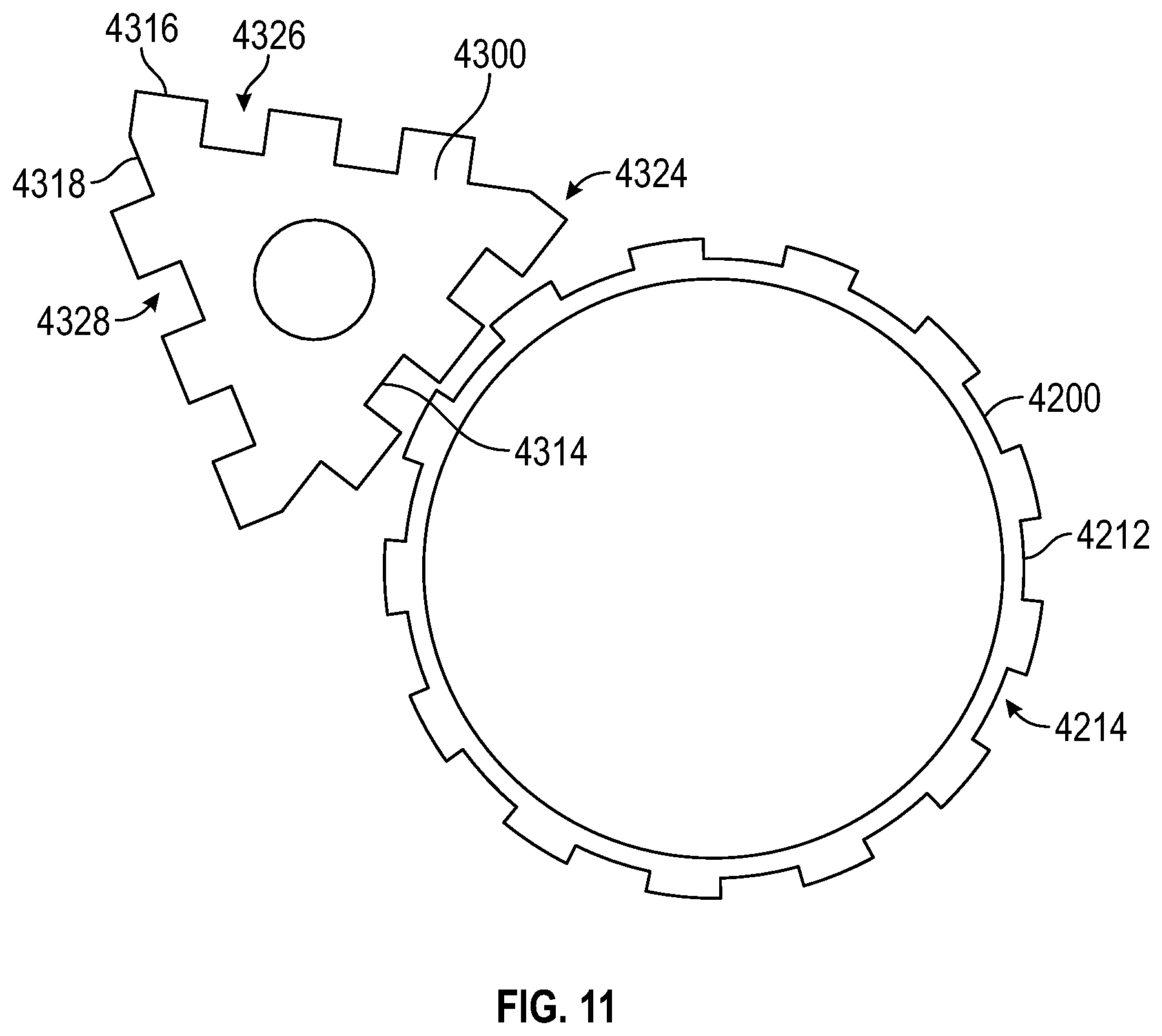Patent US12310638 Figure 8 – Modular bone reinforcement