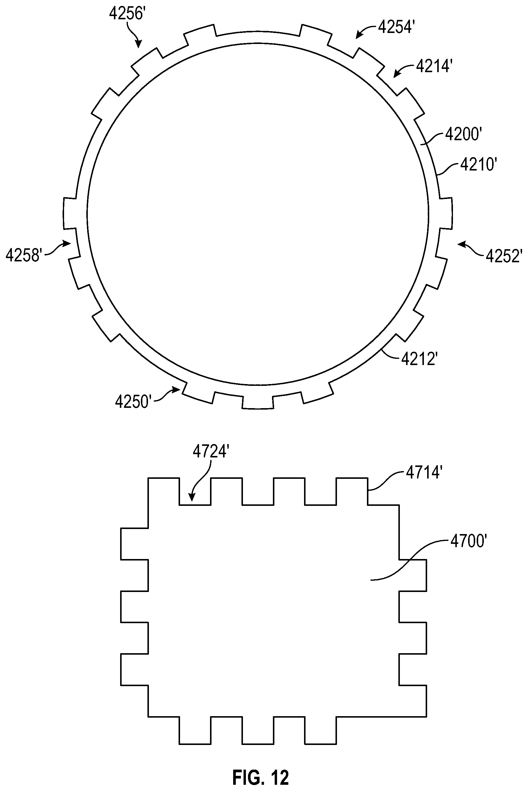 Patent US12310638 Figure 9 – Modular bone reinforcement