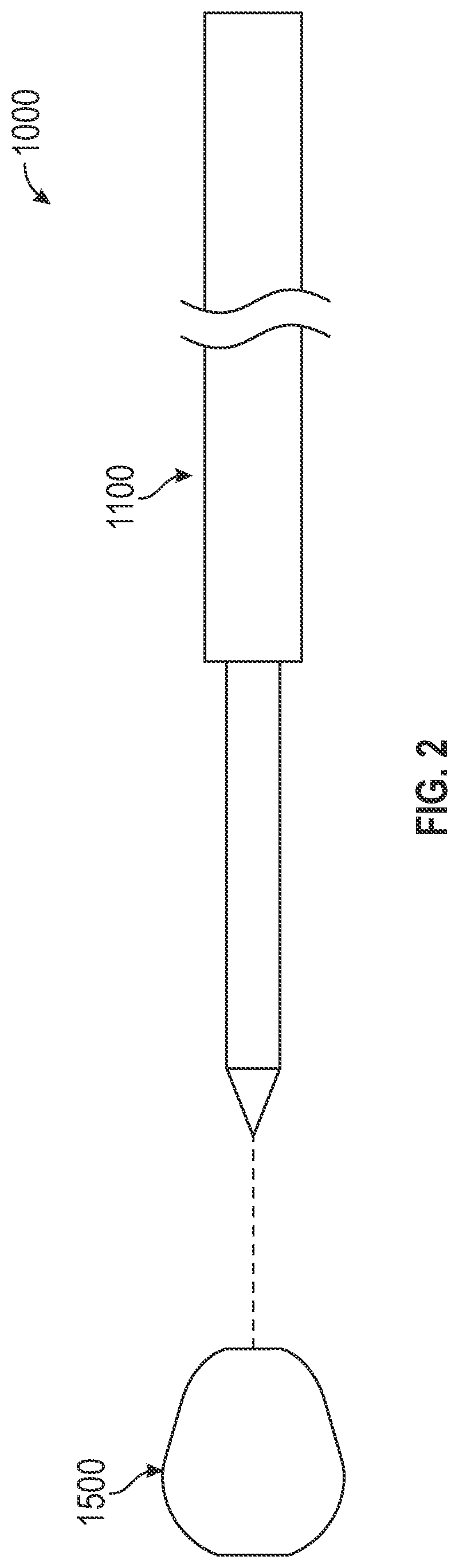 Patent US12310640 Figure 2 – Bone fixation devices, systems, kits, and methods