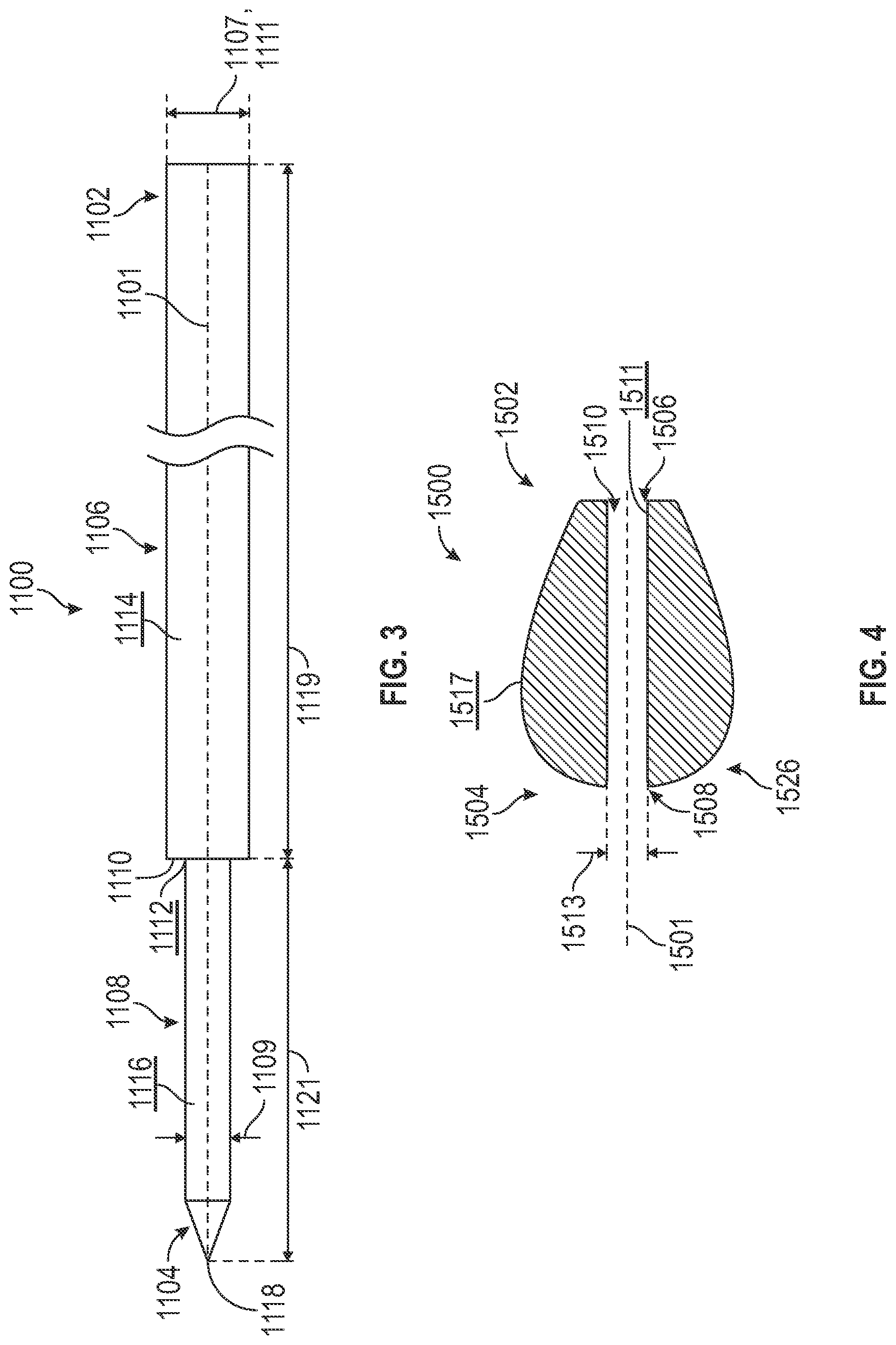Patent US12310640 Figure 3 – Bone fixation devices, systems, kits, and methods